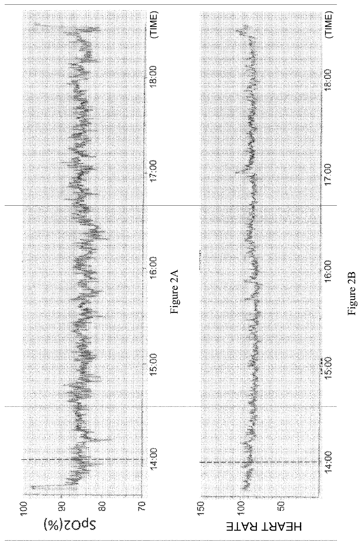 Arterial Oxygen Saturation Degree Improver