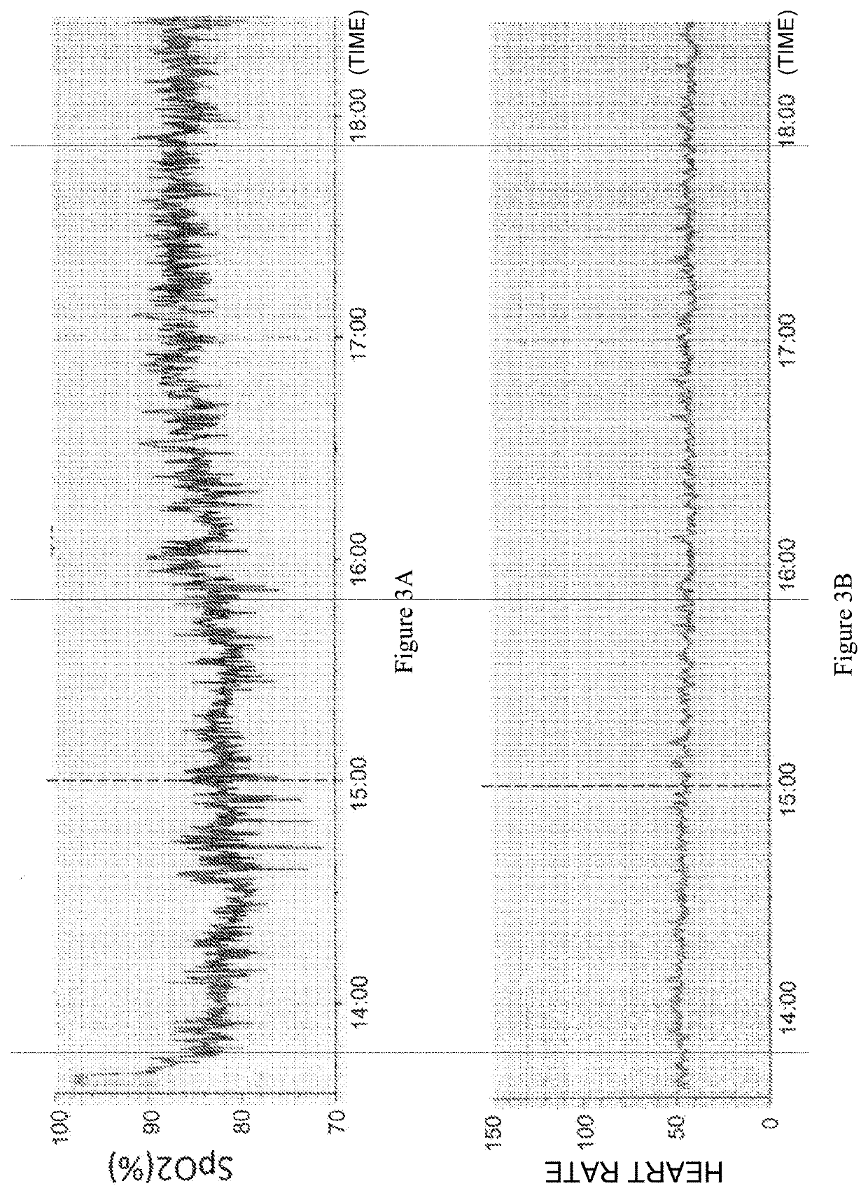 Arterial Oxygen Saturation Degree Improver