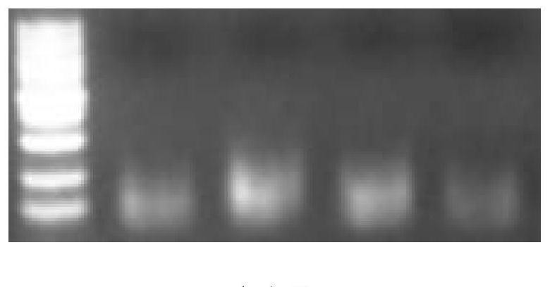 Construction method of CAMTA2 gene deletion type zebrafish