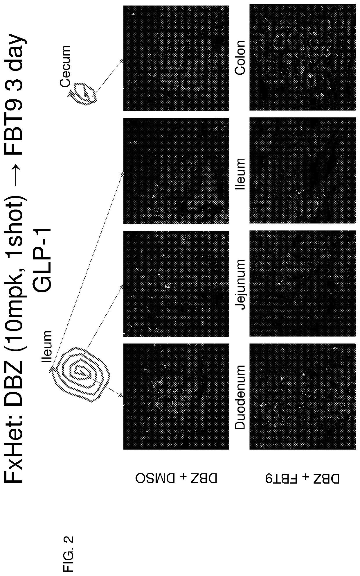 Co-Administration of inhibitors to produce insulin producing gut cells