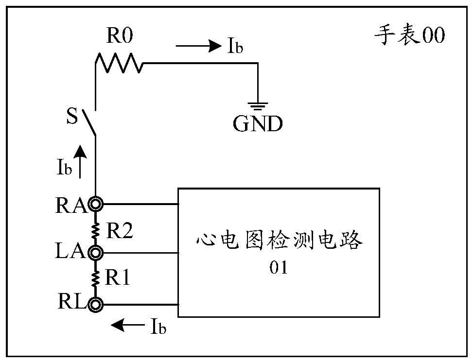Electrocardiogram detection device and detection circuit