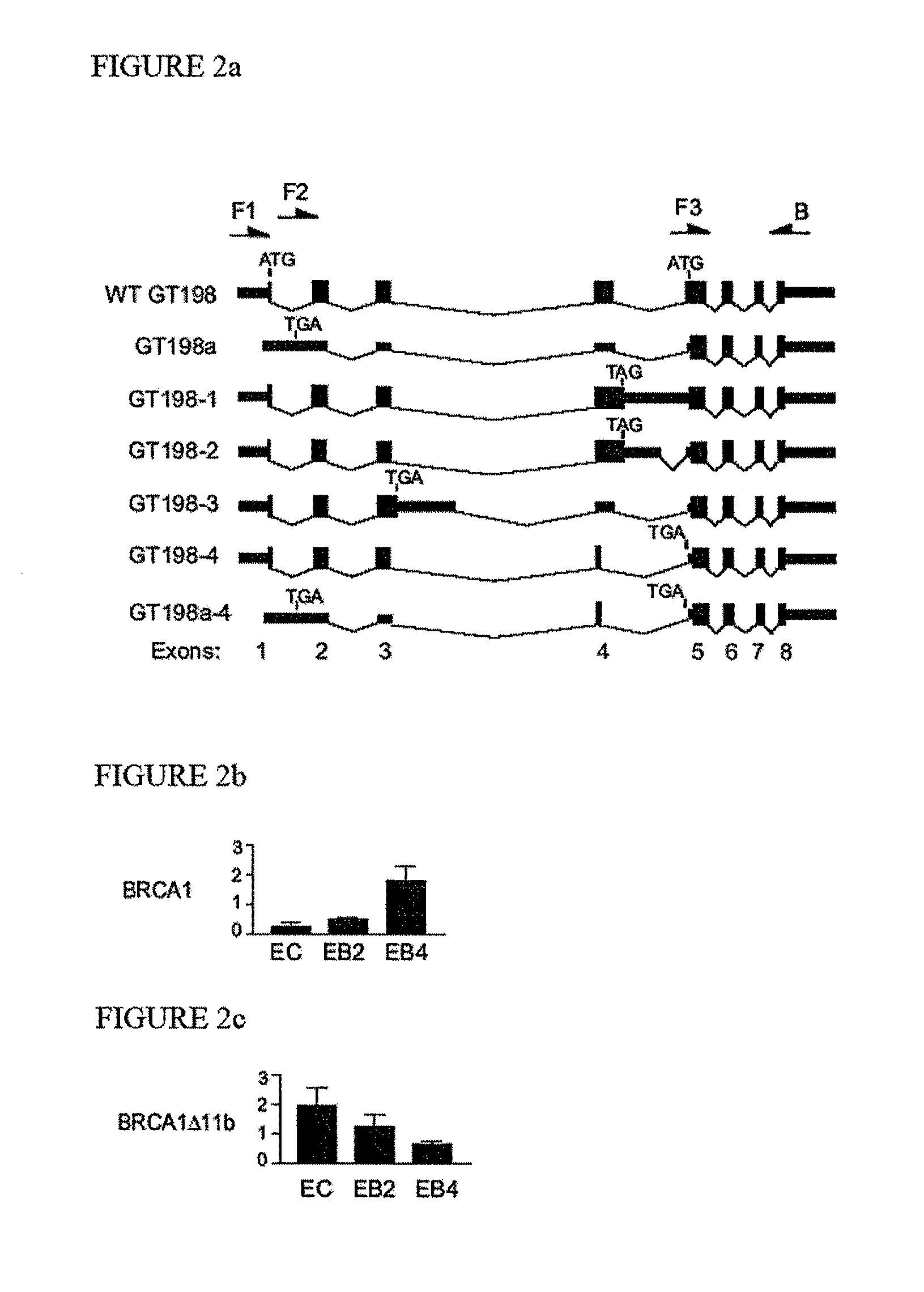 Breast Cancer Susceptibility Gene GT198 and Uses Thereof