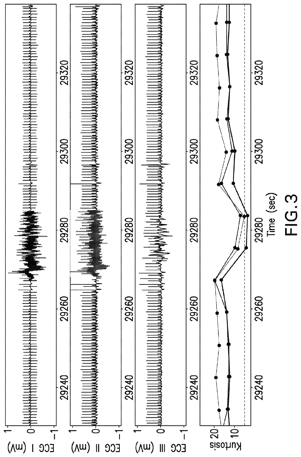 Method and system for monitoring a patient for atrial fibrillation and/or asystole