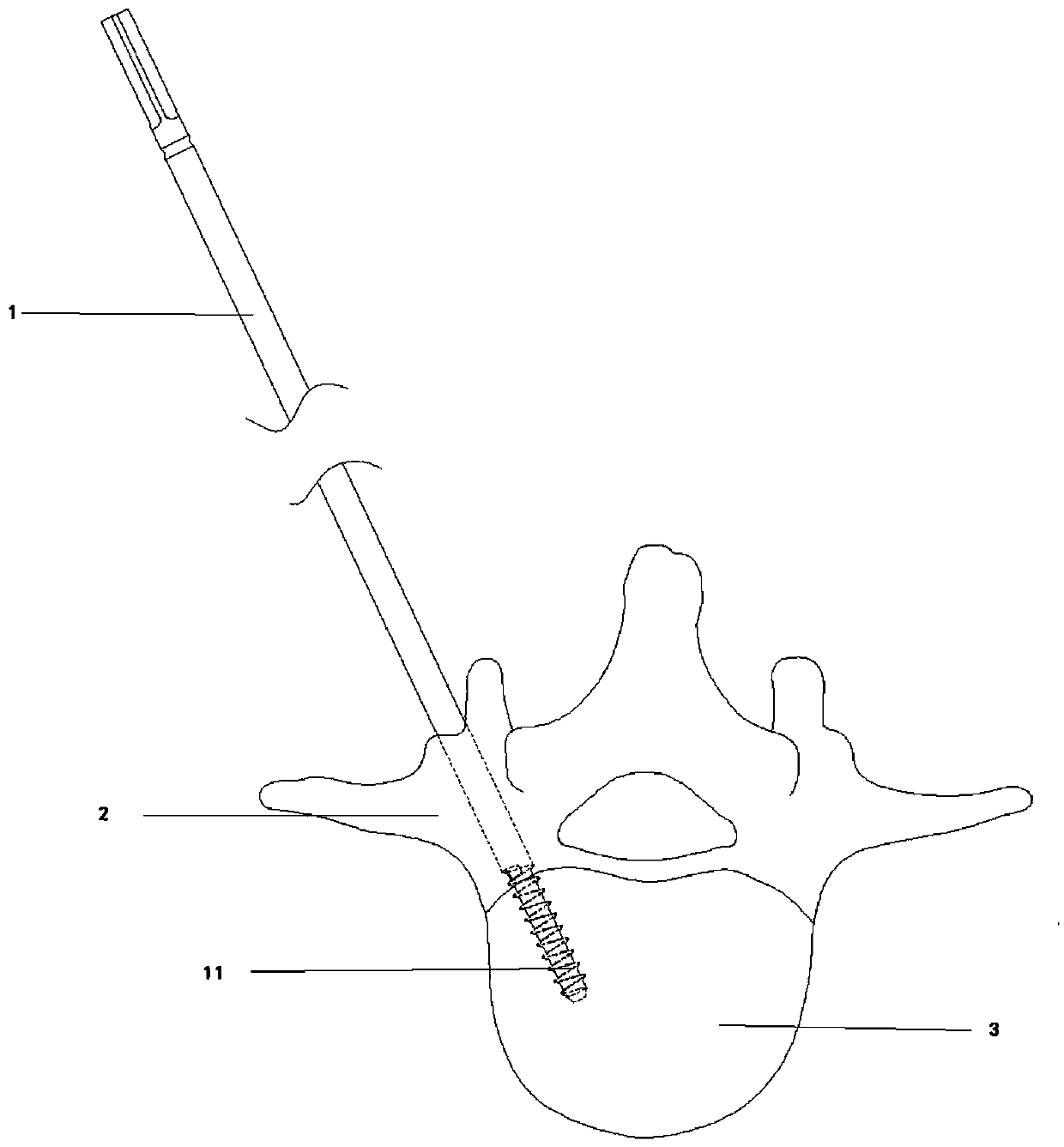 Minimally invasive facetectomy guiding and positioning device and minimally invasive facetectomy guiding and positioning instrument assembly