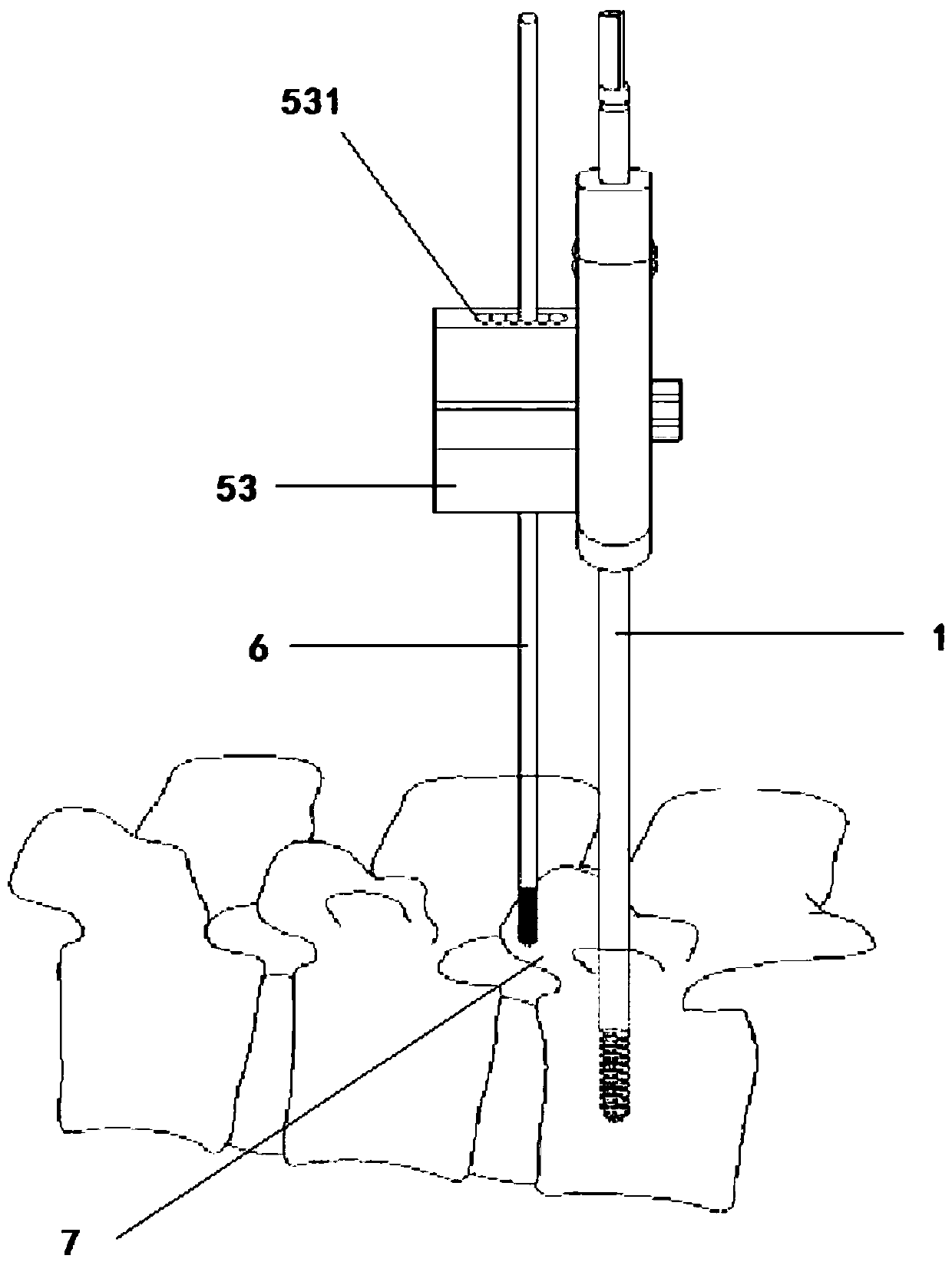 Minimally invasive facetectomy guiding and positioning device and minimally invasive facetectomy guiding and positioning instrument assembly