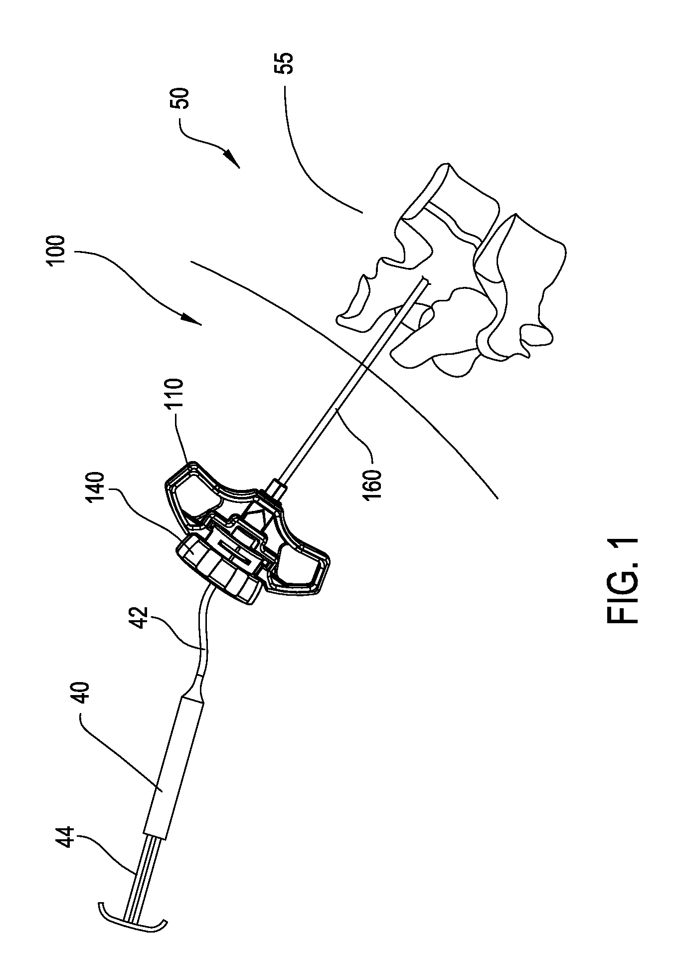 Cavity creator with integral cement delivery lumen