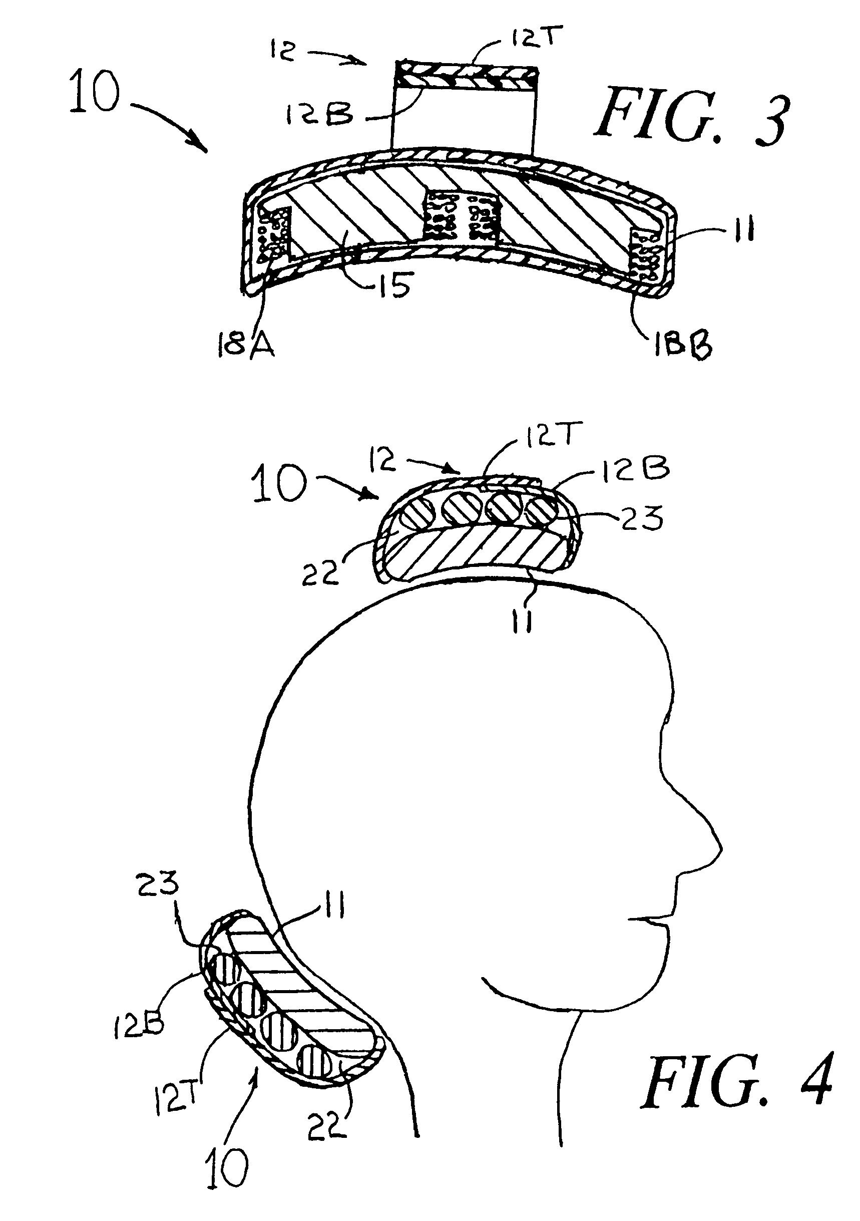 Means and methods for treating headaches