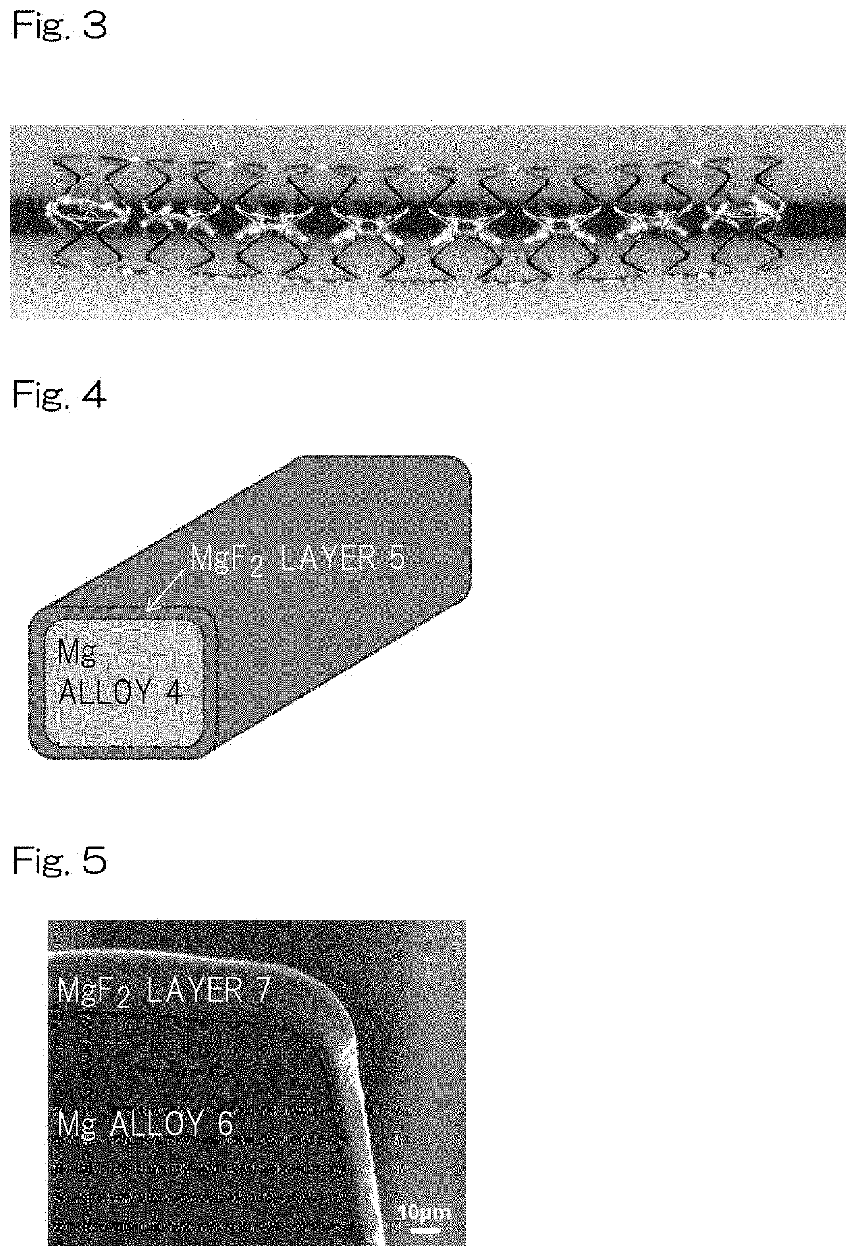 High performance bioabsorbable stent