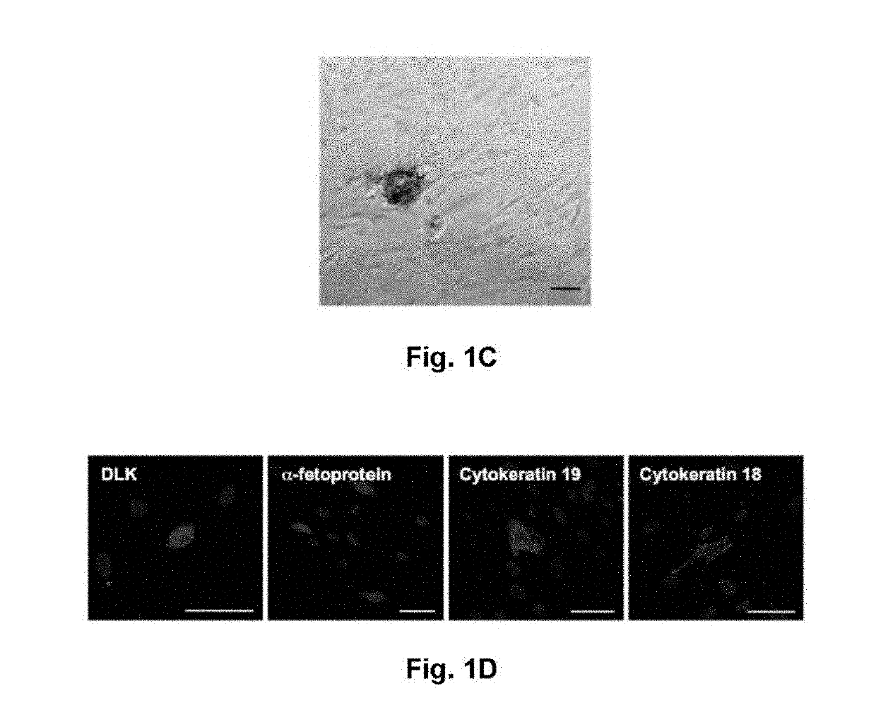 Prophylactic or therapeutic agent for organ fibrosis