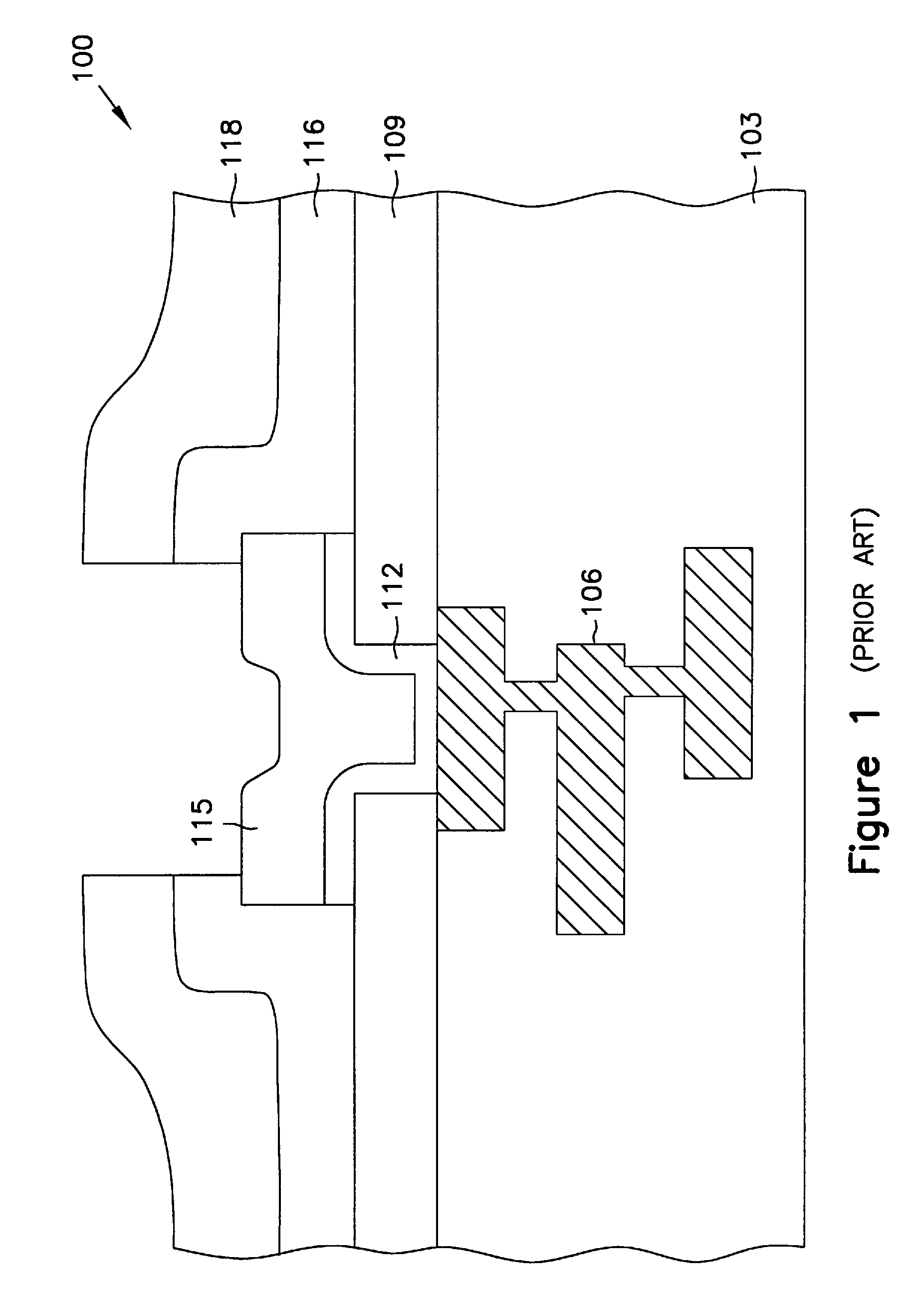 Local multilayered metallization