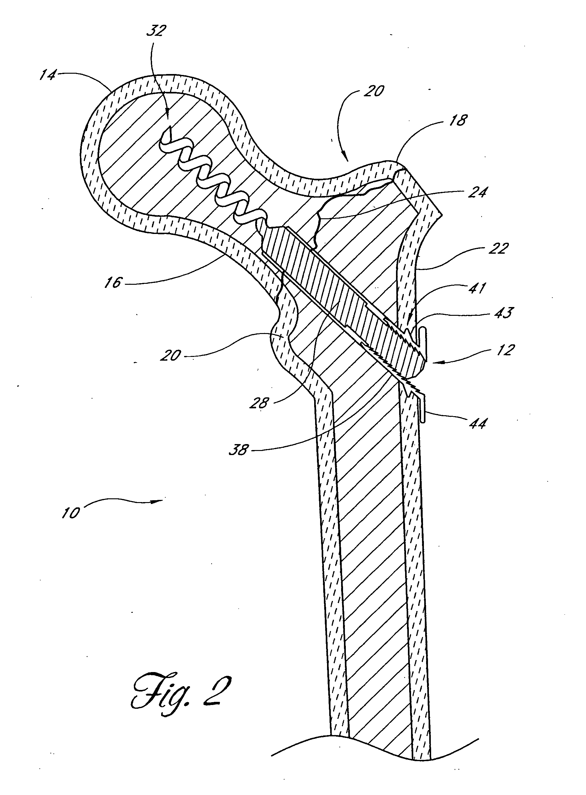 Method and apparatus for spinal fusion