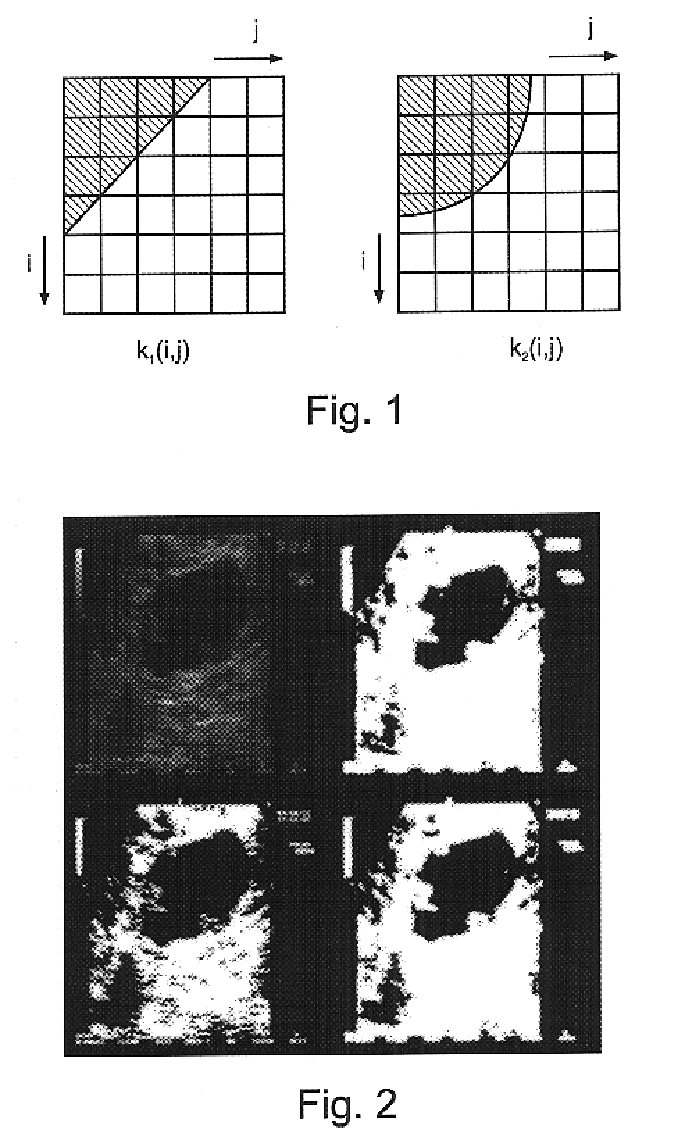 Method and system for automatic classification and quantitative evaluation of adnexal masses based on a cross-sectional or projectional images of the adnex