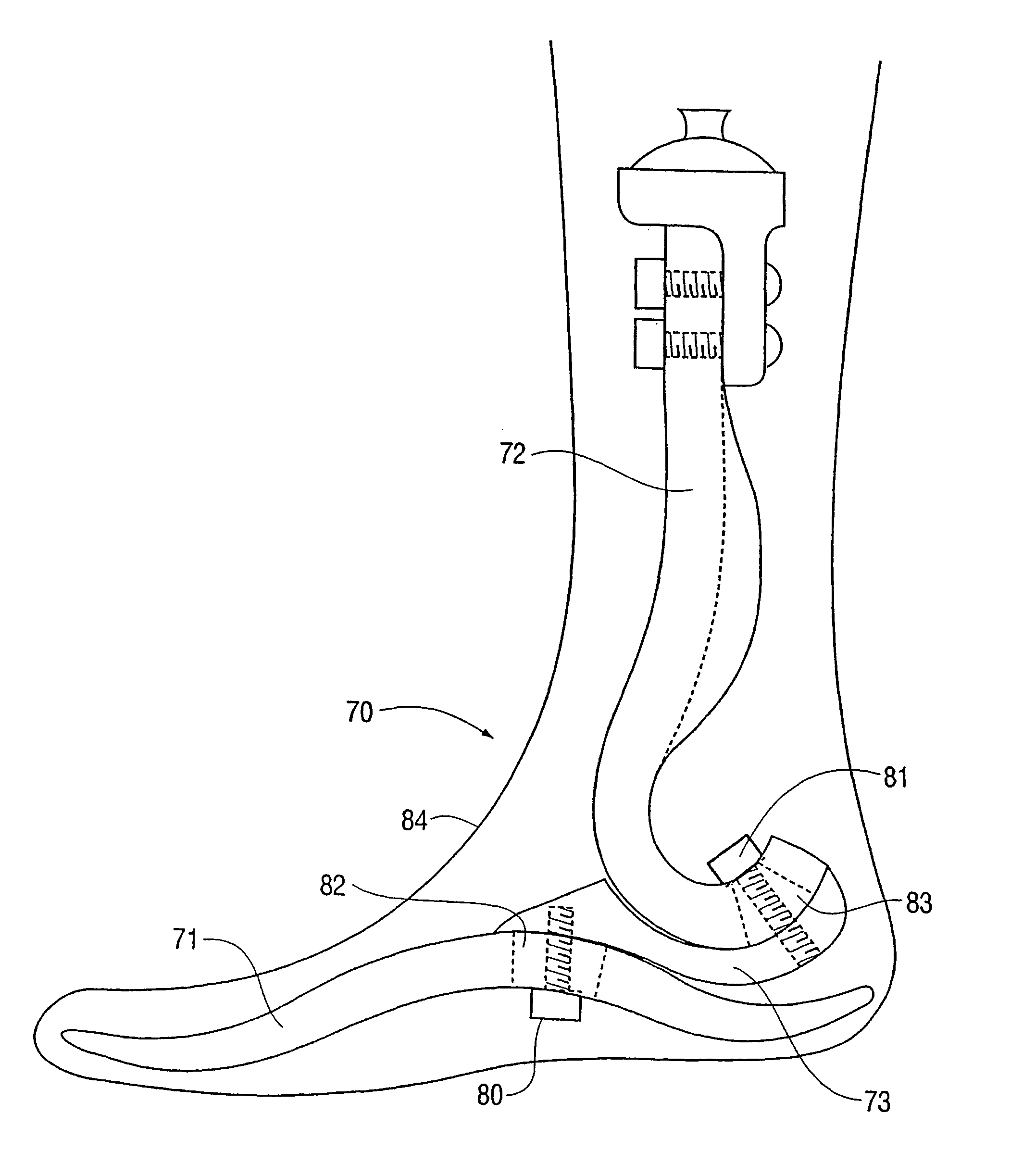 Prosthetic foot with tunable performance