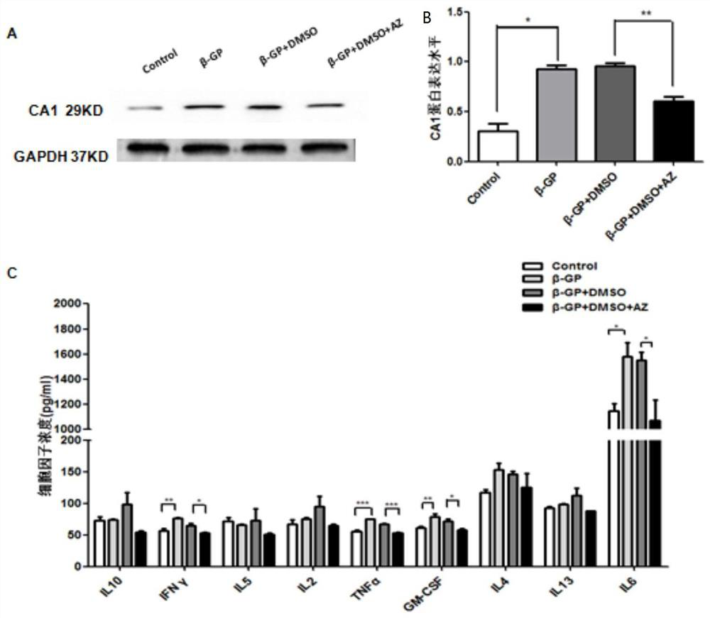 Application of carbonic anhydrase inhibitor in the preparation of anti-atherosclerotic drugs