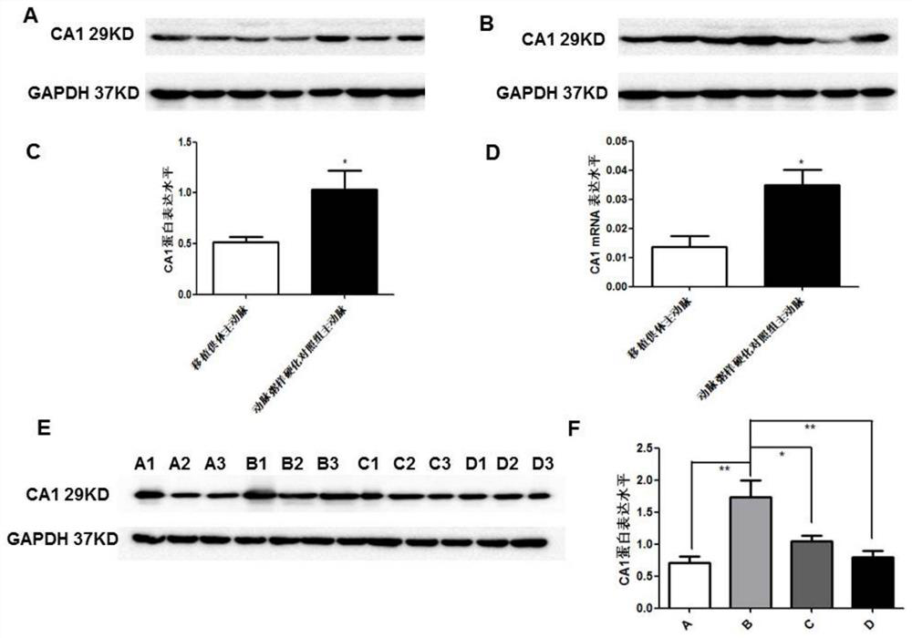 Application of carbonic anhydrase inhibitor in the preparation of anti-atherosclerotic drugs