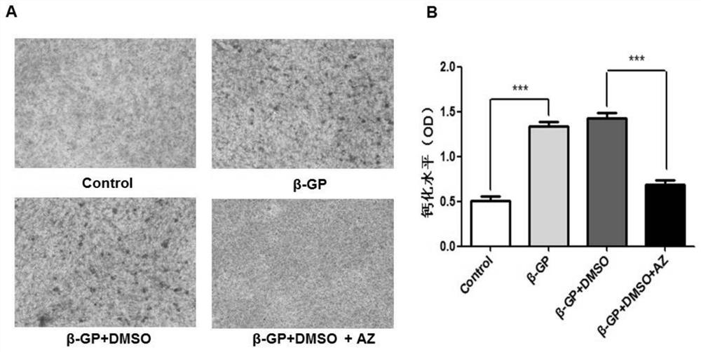 Application of carbonic anhydrase inhibitor in the preparation of anti-atherosclerotic drugs