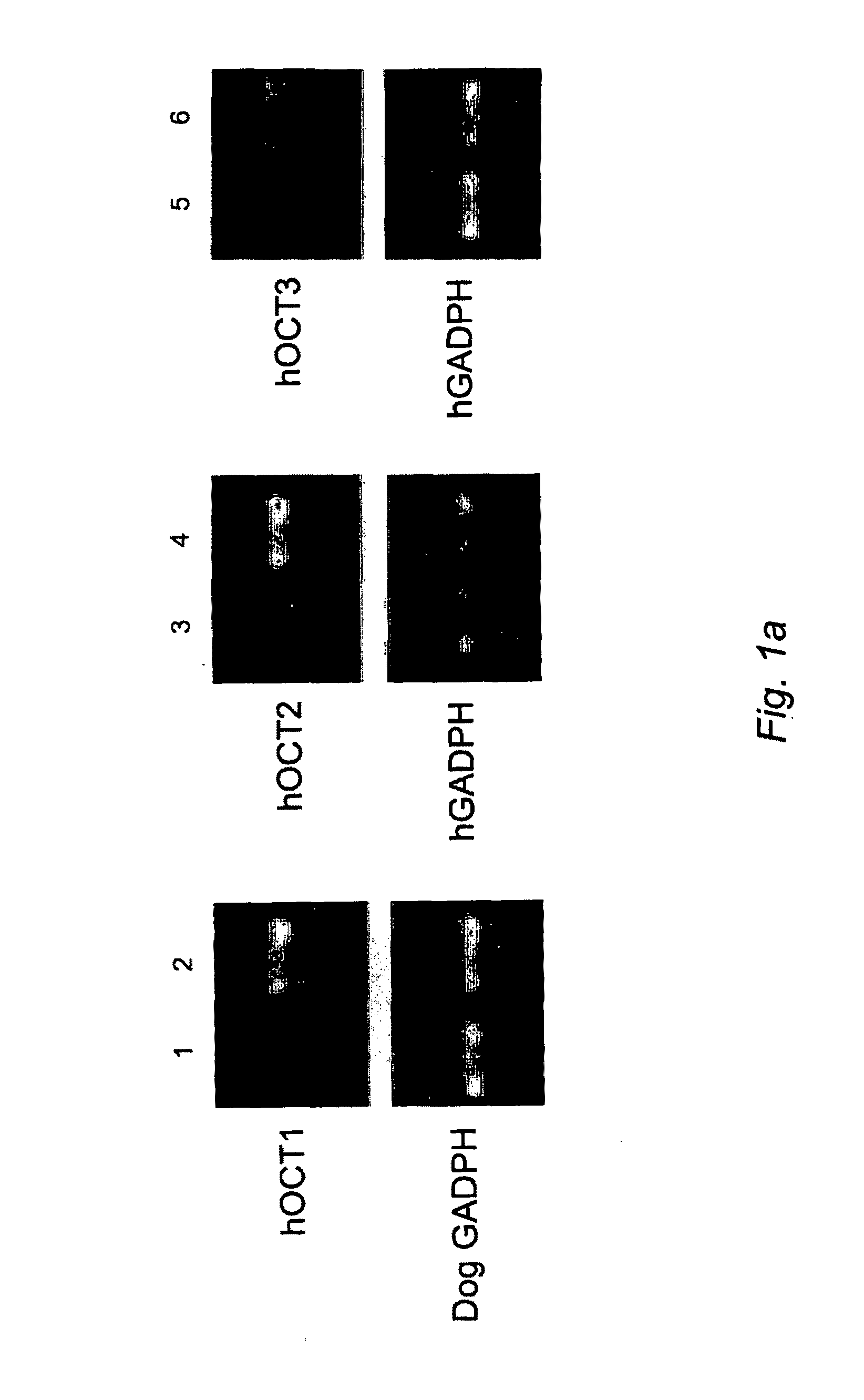 Use of organic cation transporters for cancer diagnosis and therapy