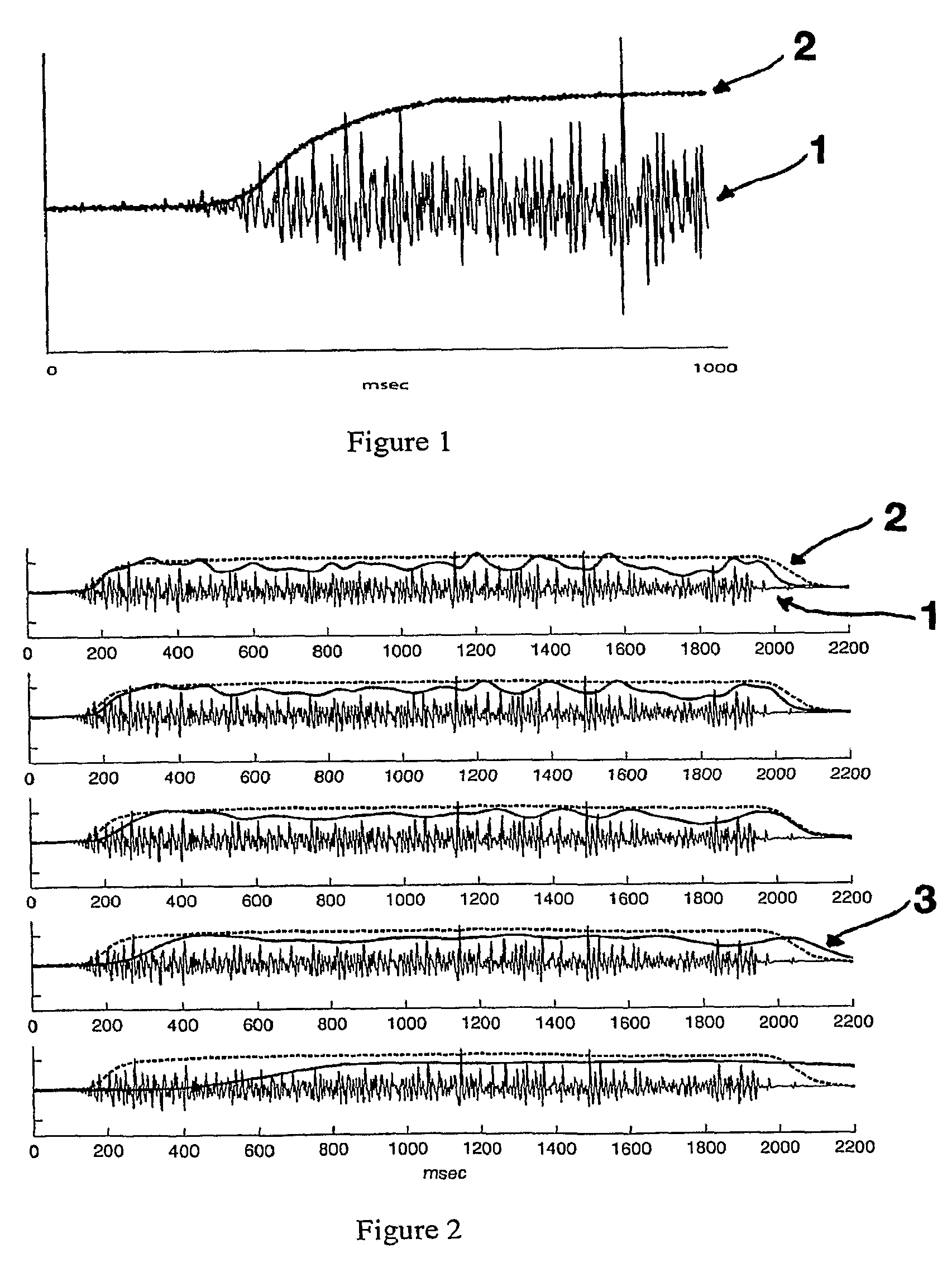 Systems and methods for estimating surface electromyography