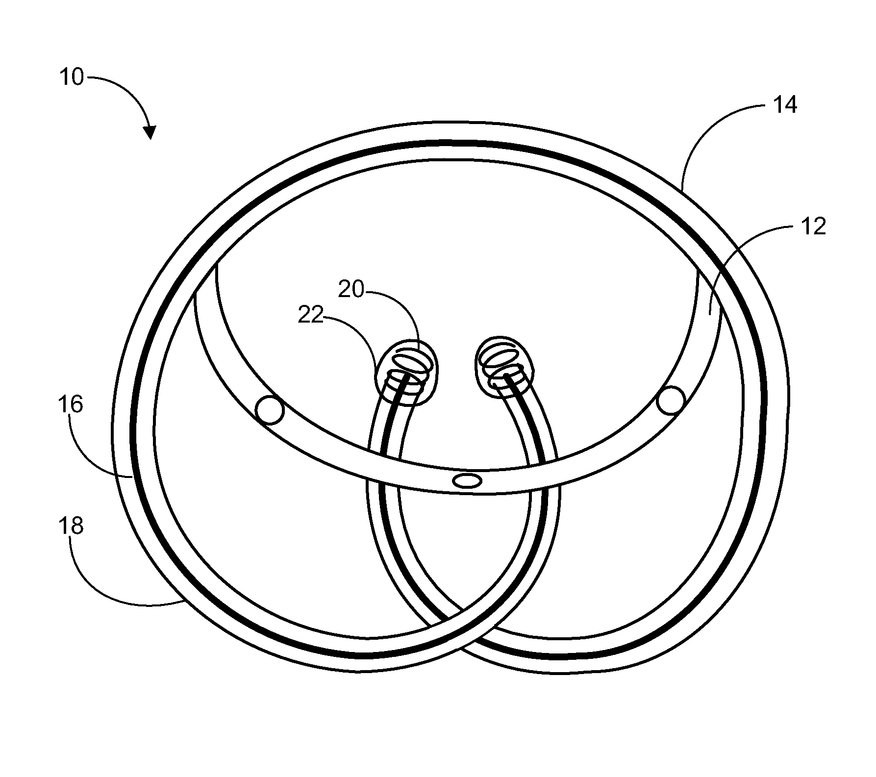 Implantable drug delivery device and methods for treatment of the bladder and other body vesicles or lumens