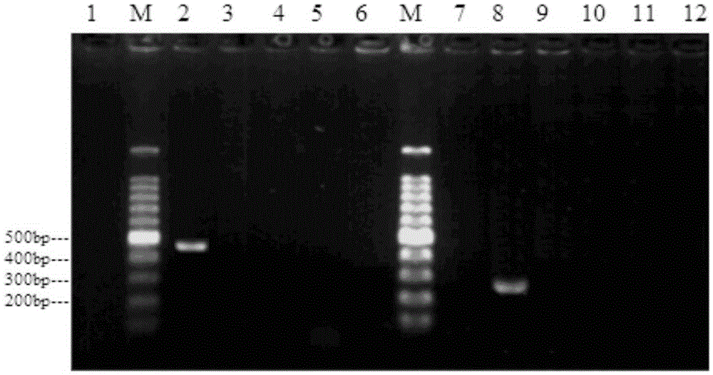 Primers and method for detection of enterobacter cloacae O20 type