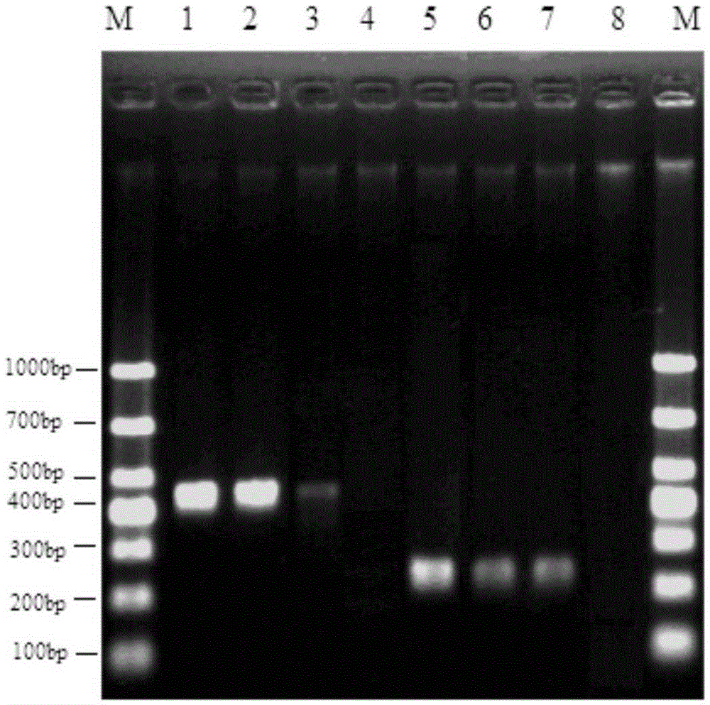 Primers and method for detection of enterobacter cloacae O20 type