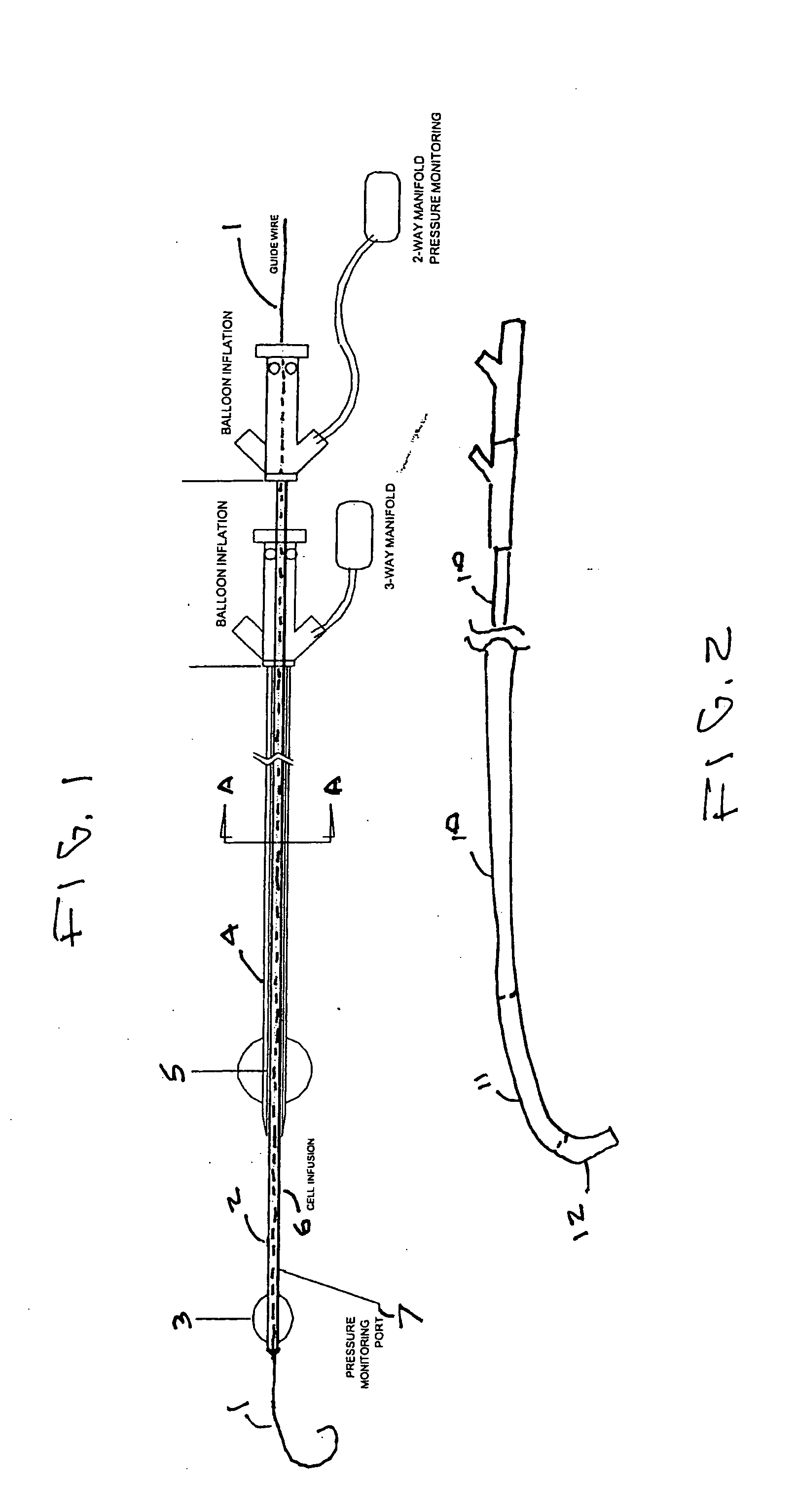 Method and apparatus for localized drug delivery