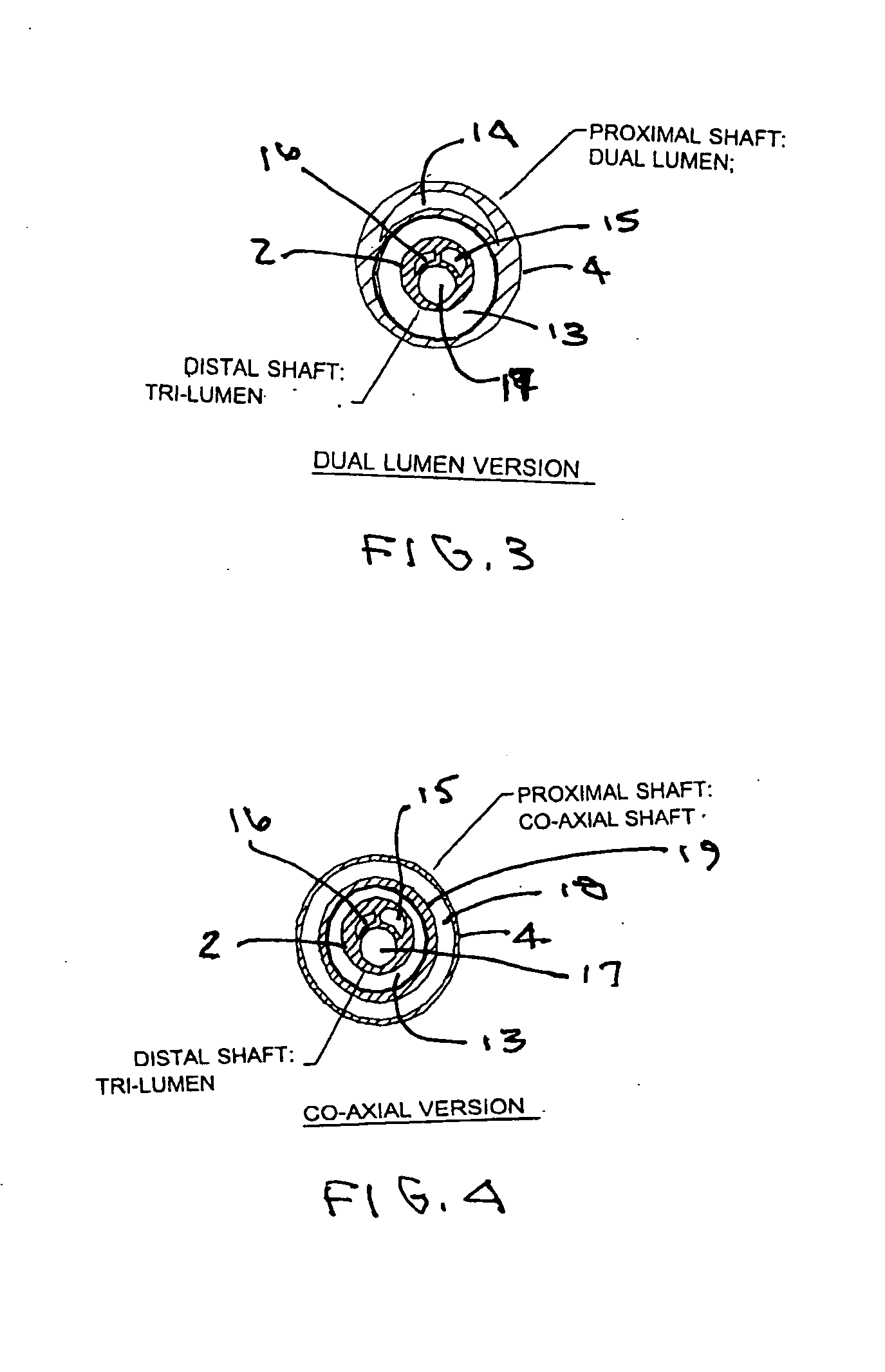 Method and apparatus for localized drug delivery