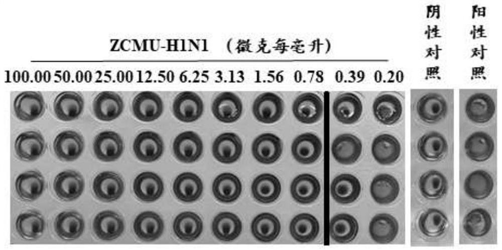 Anti-H1N1 influenza virus hemagglutinin protein monoclonal antibody ZCMU-H1N1 with neutralizing activity and application thereof