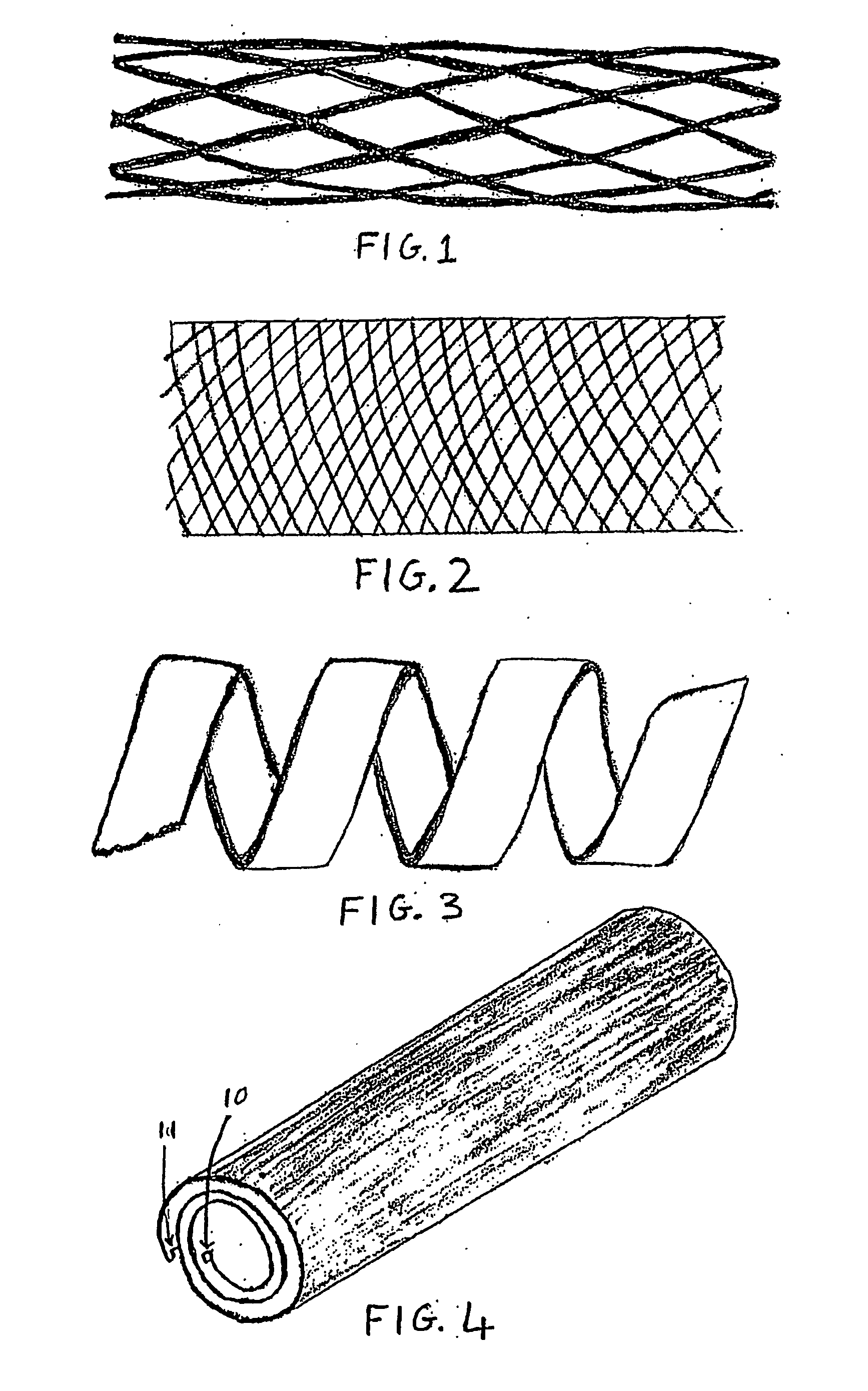 Amorphous alloy stents