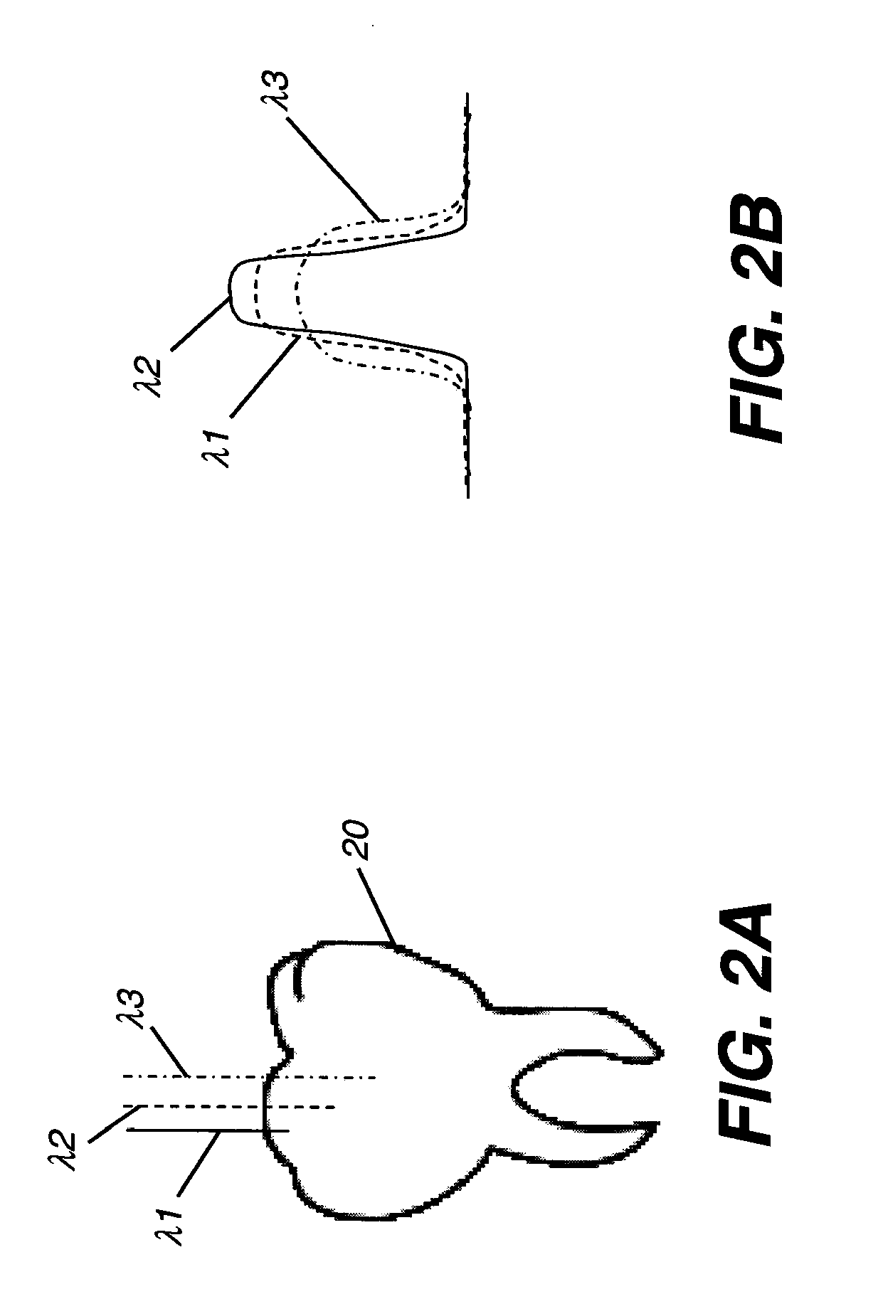Apparatus for dental surface shape and shade imaging