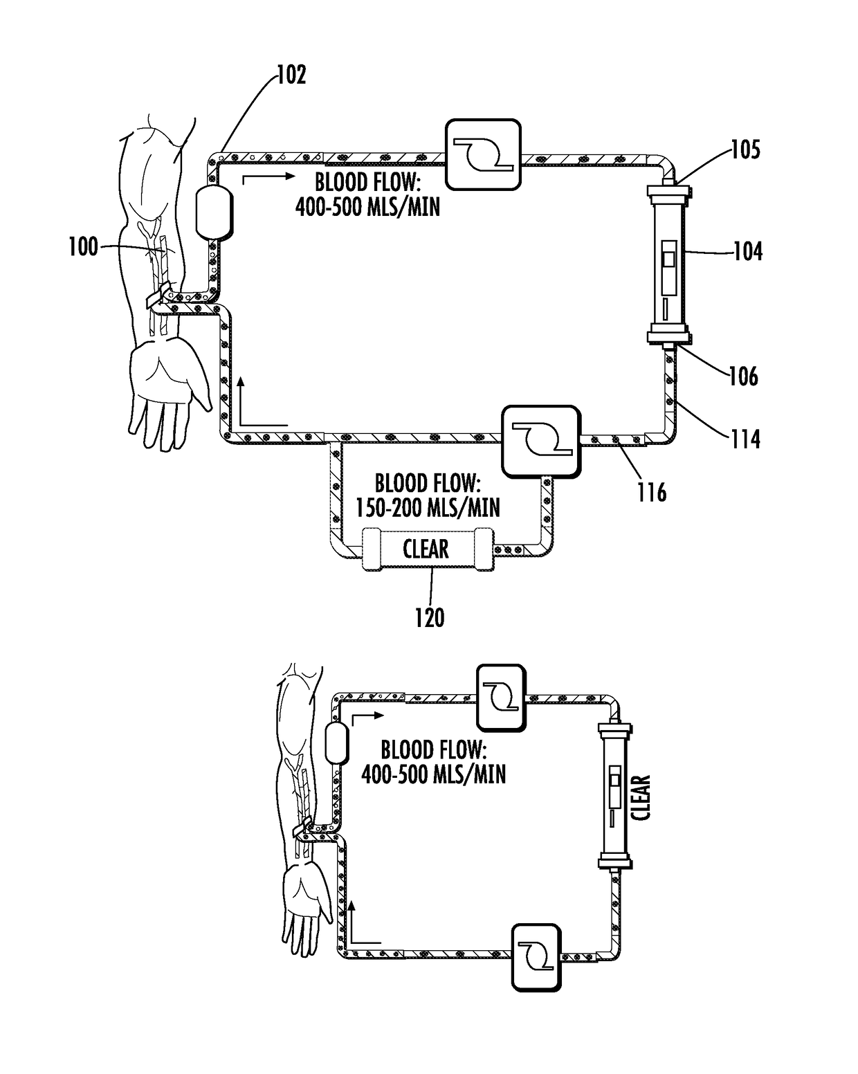 Methods and apparatus for kidney dialysis and extracorporeal detoxification