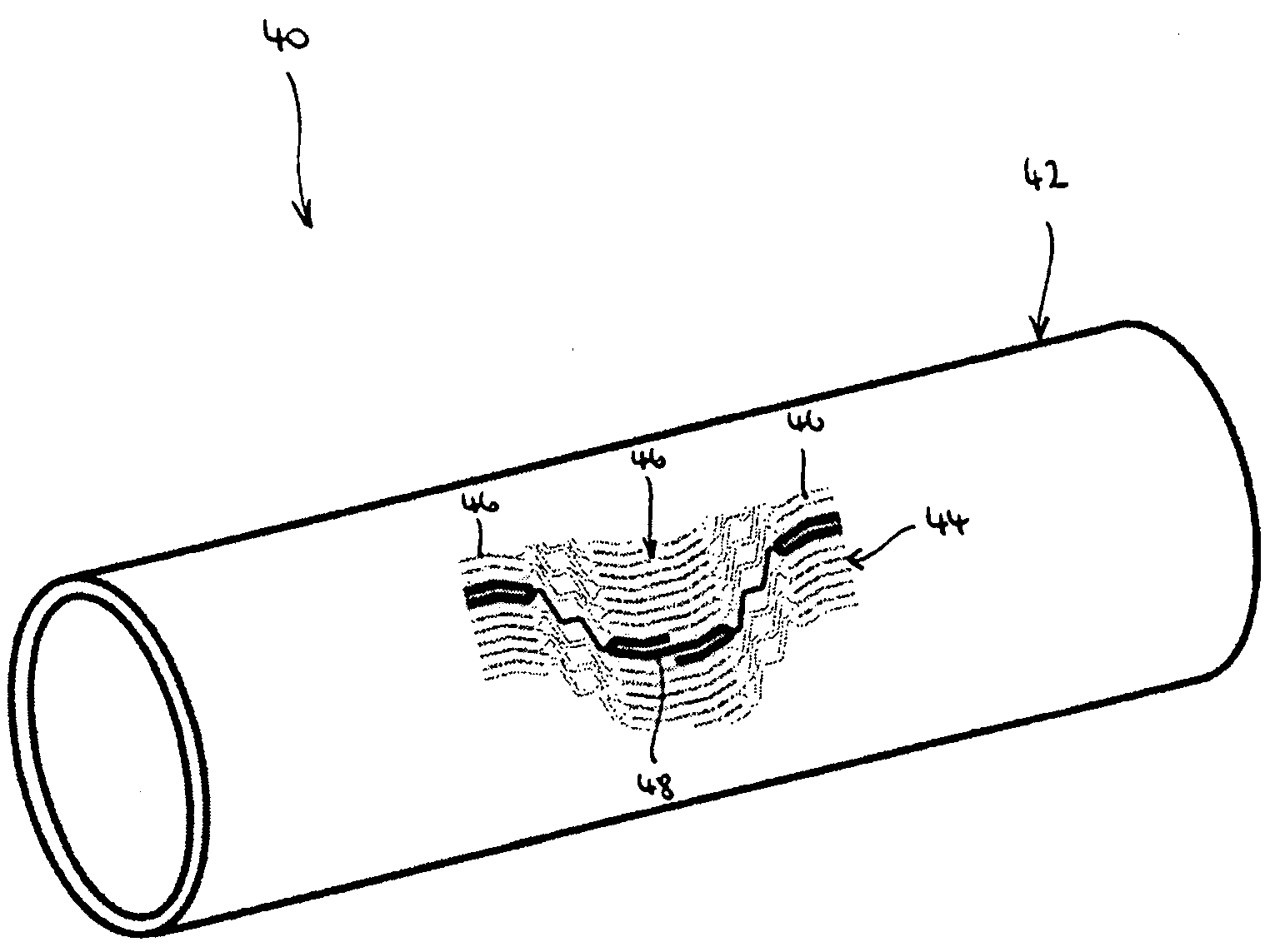 Flexible stent with torque-absorbing connectors