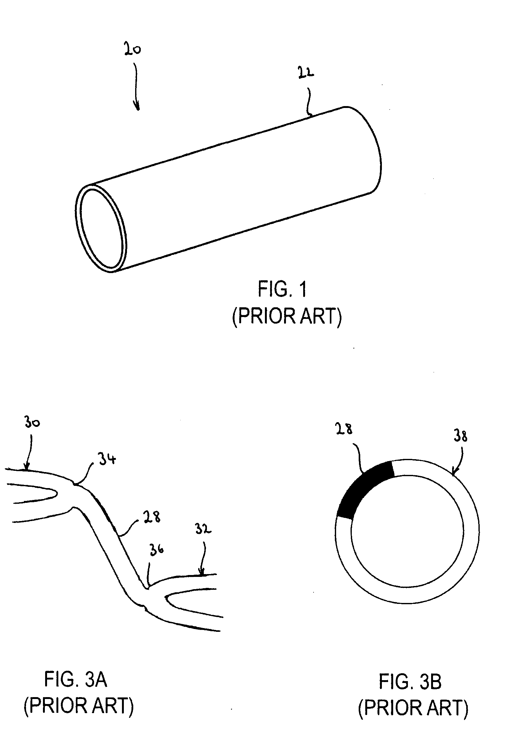 Flexible stent with torque-absorbing connectors