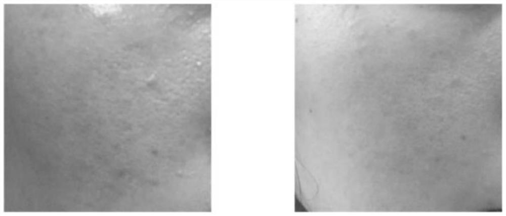 A purification solution based on biologically active colloidal nano-sulfur particles and methionine for the treatment of mite dermatitis