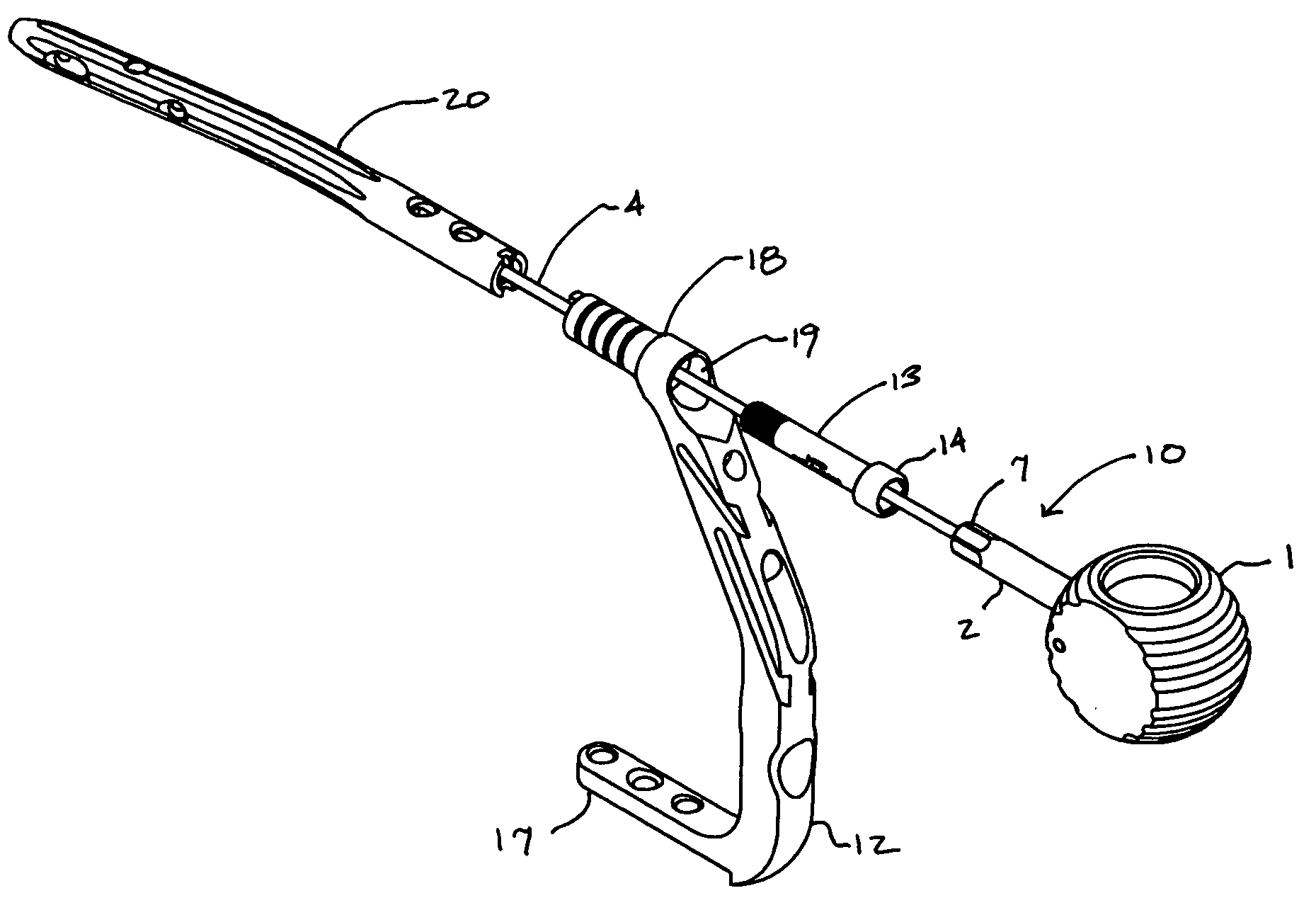 Implant assembly device