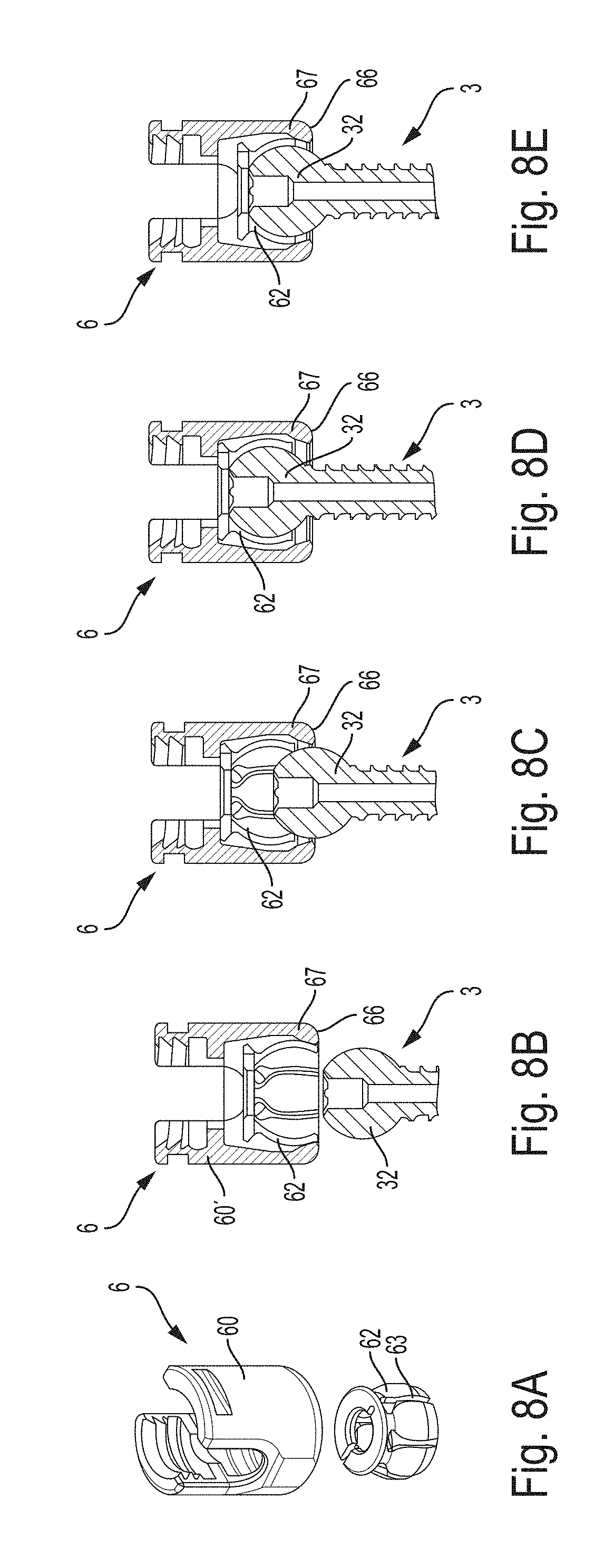Spinal multi-level intersegmental stabilization system and method for implanting