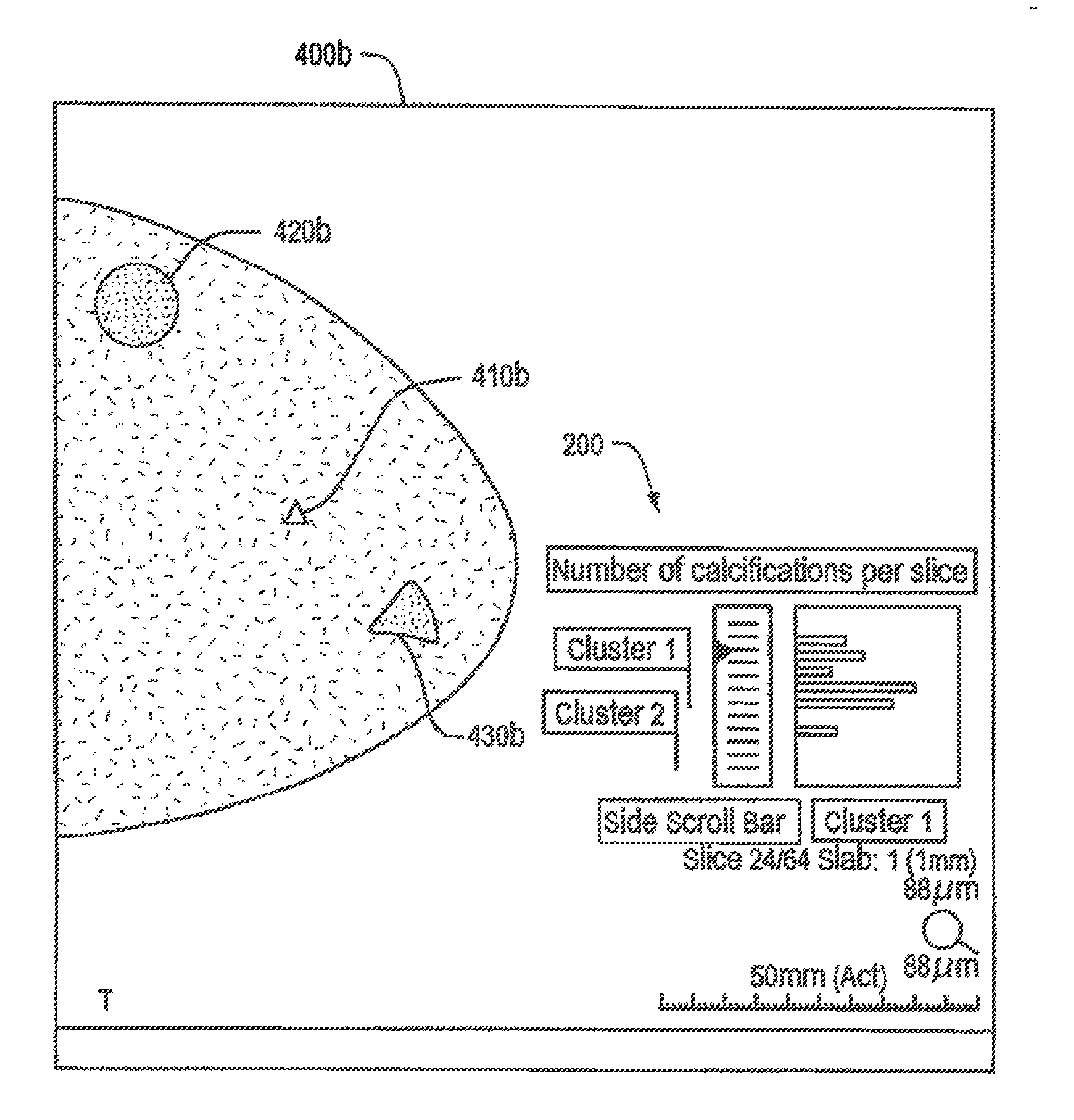 System and Method for Generating A 2D Image from a Tomosynthesis Data Set