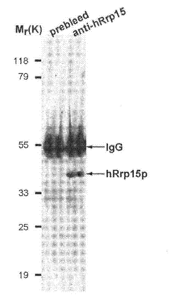 Human ribosomal protein molecules hRrp15p and preparation method and application thereof