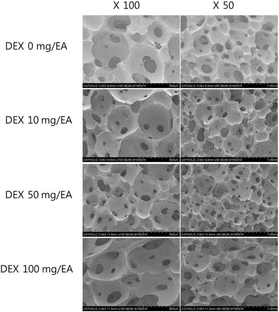 Process for preparing polyurethane foam dressing comprising anti-inflammatory agent