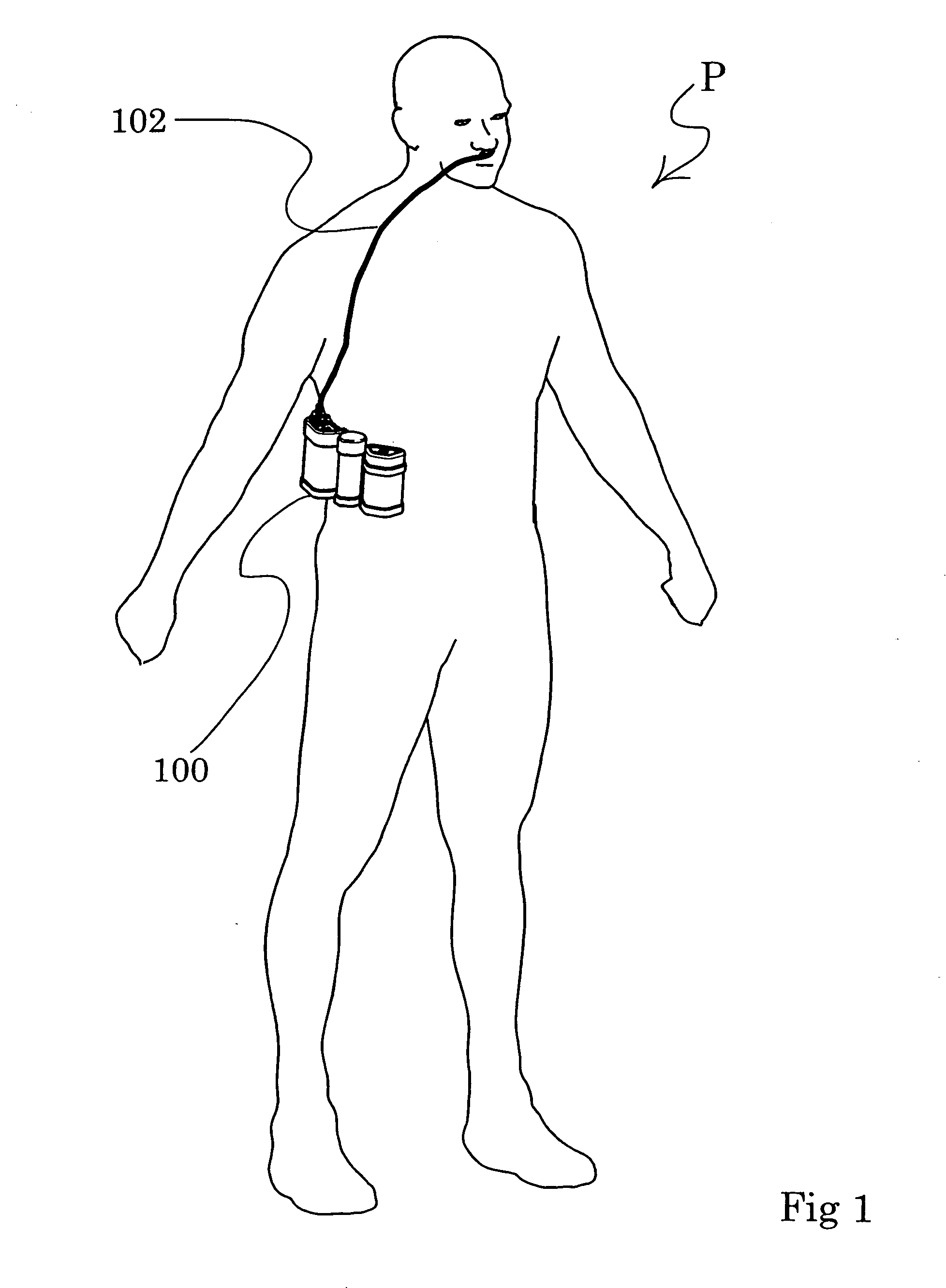 Ambulatory oxygen concentrator containing a three phase vacuum separation system