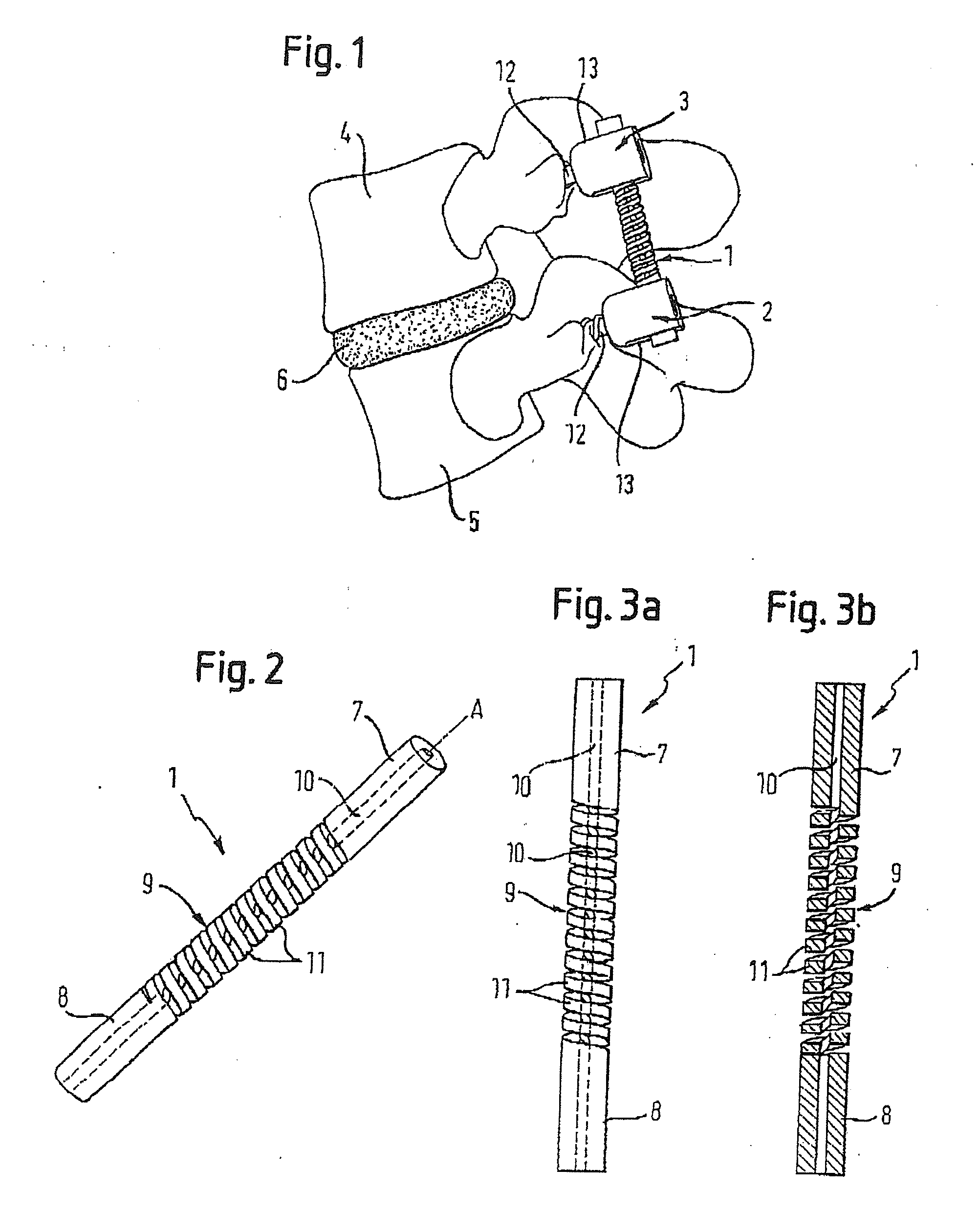 Rod-shaped implant element with flexible section