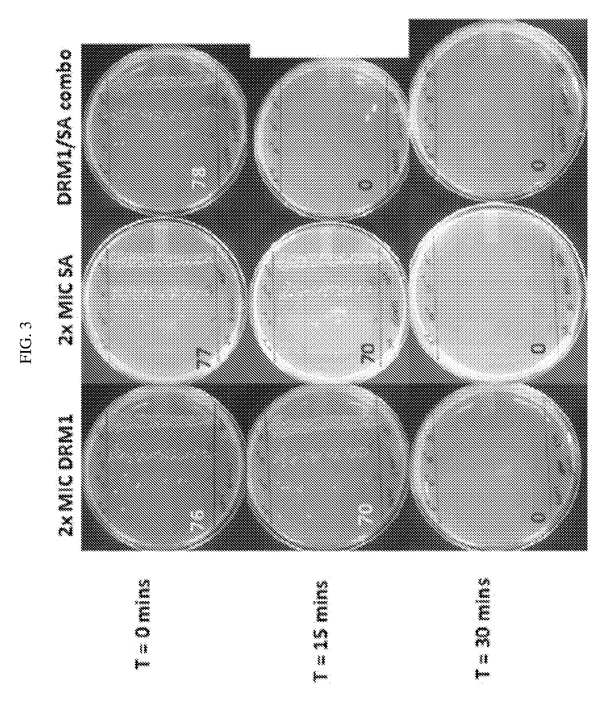 Compositions and methods for treating acne vulgaris