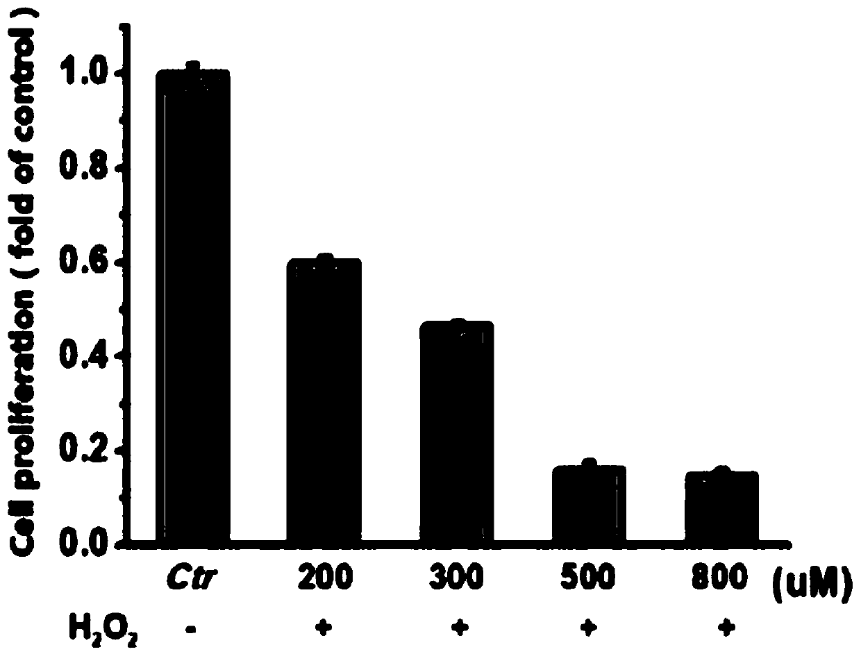 Application of lycium barbarum polysaccharide to preparation of medicaments for preventing and treating eye diseases