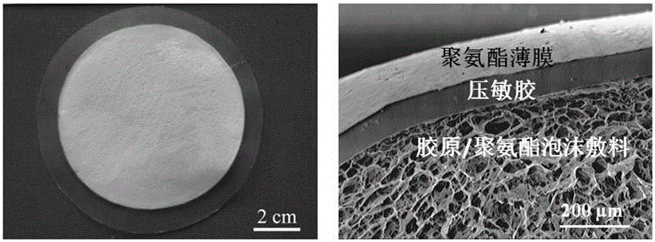 Double-layer polyurethane-based collagen-compounded dressing