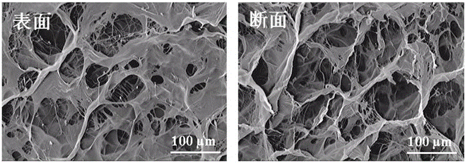 Double-layer polyurethane-based collagen-compounded dressing