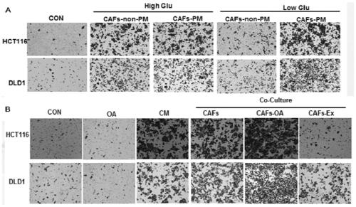 Application of fatty acid oxidation inhibitor in preparing medicine for treating colorectal cancer