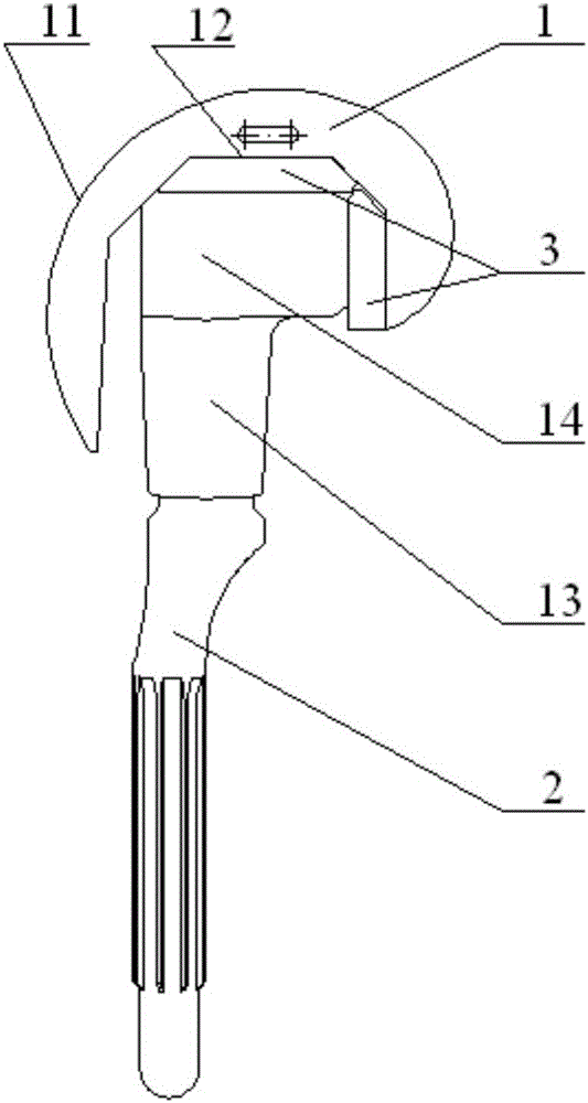 Femur prosthesis assembly system suitable for different types of femur malformation and defects