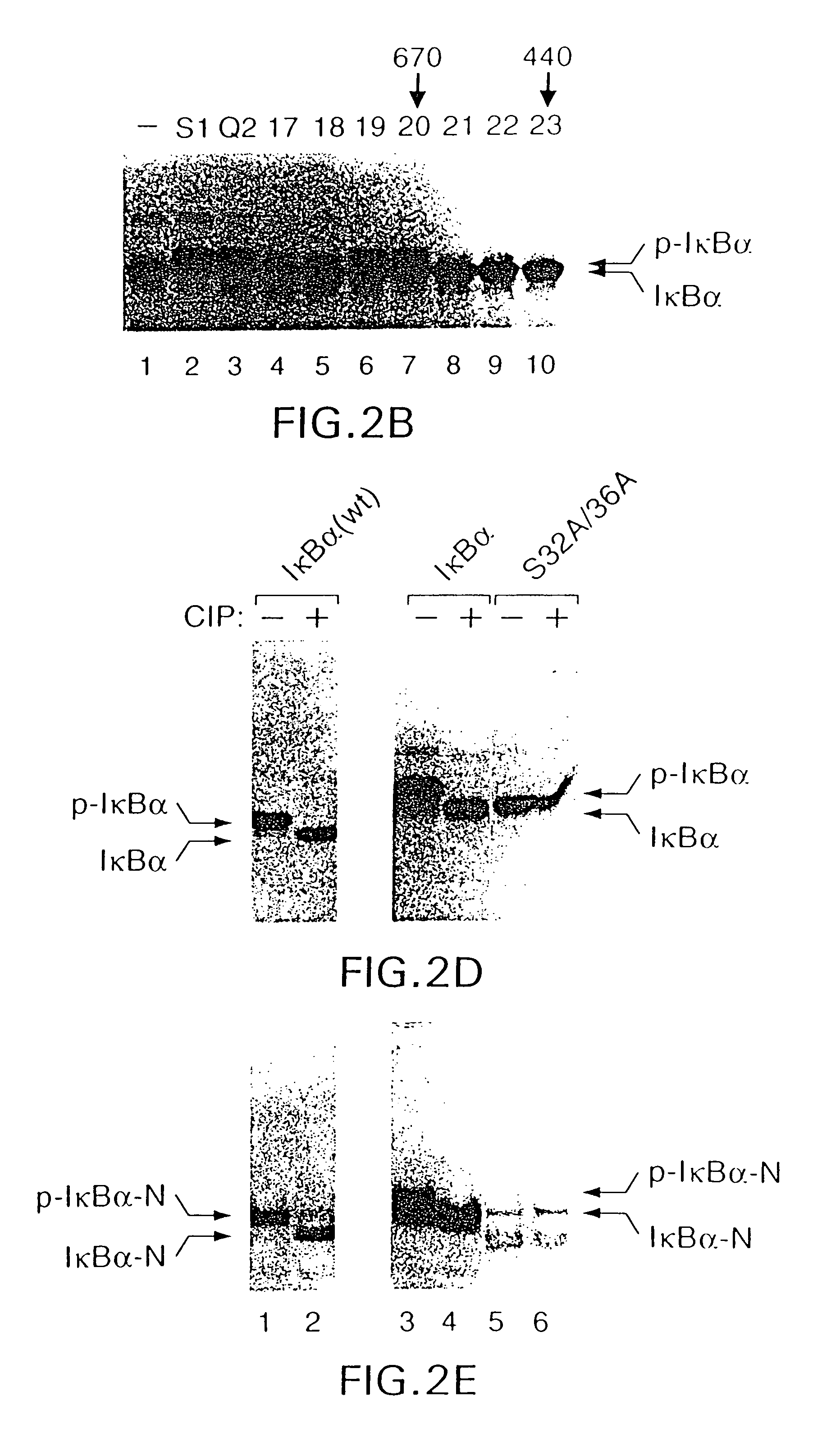 Antibody to a kinase capable of site-specific phosphorylation of IkappaBalpha