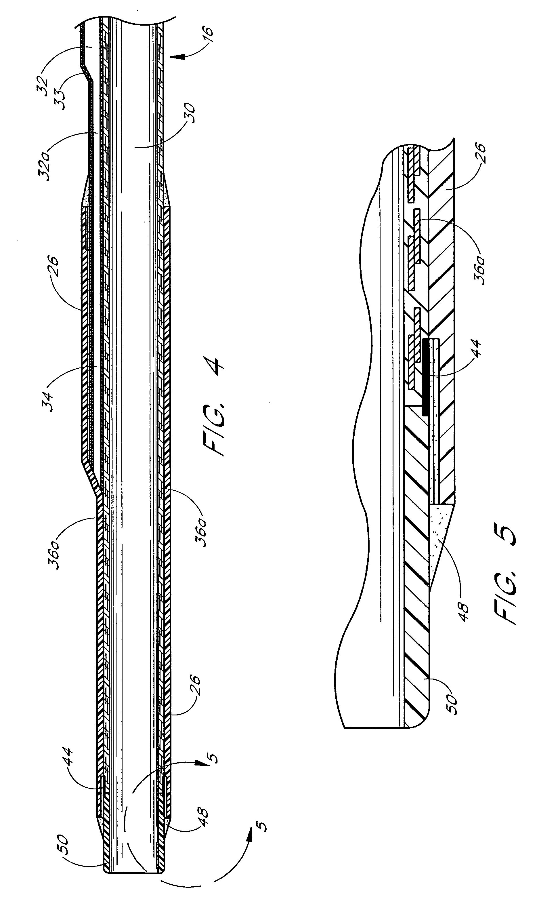 Method and apparatus for emboli containment