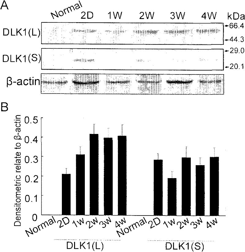 Applications of DLK1 gene, siRNA (small interference Ribonucleic Acid), BM-MSCs (Bone Marrow Mesenchymal Stem Cells) and FGF2 (Fibroblast Growth Factor2)